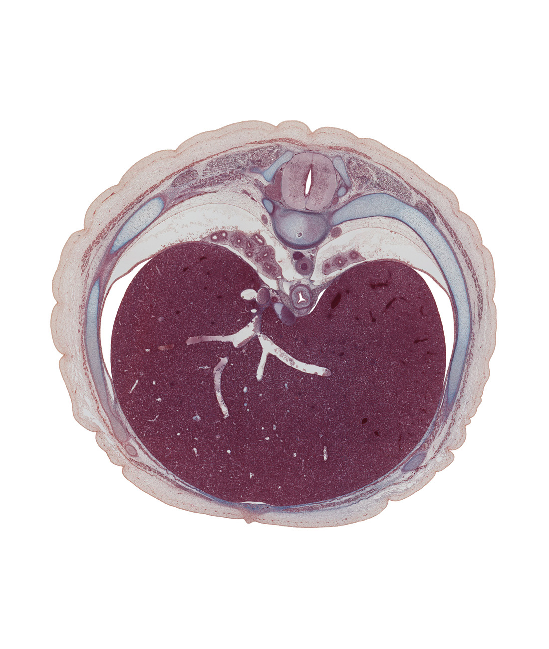 T-8 / T-9 intervertebral disc, T-8 spinal ganglion, aorta, azygos vein, costal margin, ductus venosus, efferent hepatic vein, esophageal nerve plexus, esophagus, inferior vena cava, intermediate hepatic vein, latissimus dorsi muscle, left hepatic vein, left lobe of liver, linea alba, neural arch, normal spina bifida occulta, notochord, ramus of greater splanchnic nerve, rib 9, right hepatic vein, right lobe of liver, trapezius muscle, tributary of right hepatic vein