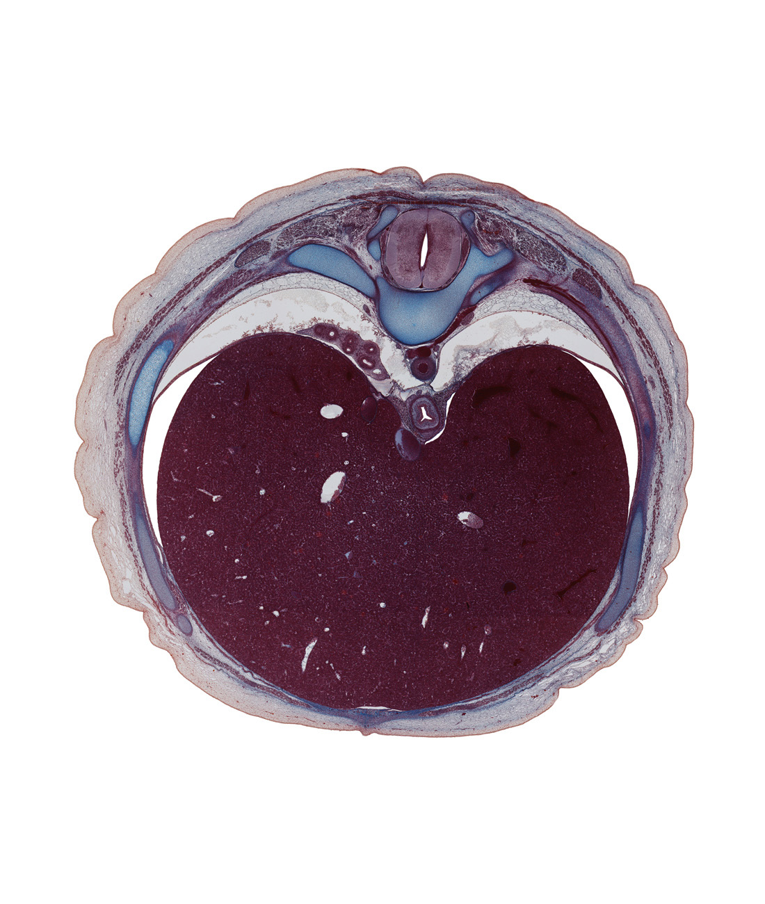 T-9 rib, T-9 spinal ganglion, anastomosis between azygos and hemi-azygos veins, aorta, costal margin, diaphragm, dorsal meso-esophagus, ductus venosus, efferent hepatic vein, inferior vena cava, left lobe of liver, linea alba, lower lobe of right lung, parietal pleura, peritoneal cavity, ramus of greater splanchnic nerve, rectus abdominis muscle, right lobe of liver, sympathetic trunk