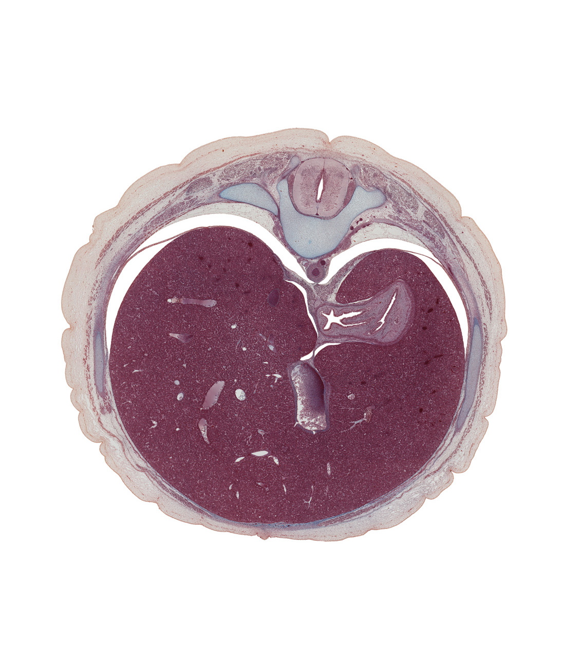 T-10 intercostal nerve, T-10 spinal ganglion, anterior rectus sheath, aorta, cardiac portion of stomach, ductus venosus, external abdominal oblique muscle, fundus of stomach, greater sac, inferior vena cava, junction of esophagus and stomach, latissimus dorsi muscle, left lobe of liver, linea alba, pleural recess, rectus abdominis muscle, rib 10, right crus of diaphragm, right lobe of liver, sympathetic trunk, ventral mesogastrium (lesser omentum)