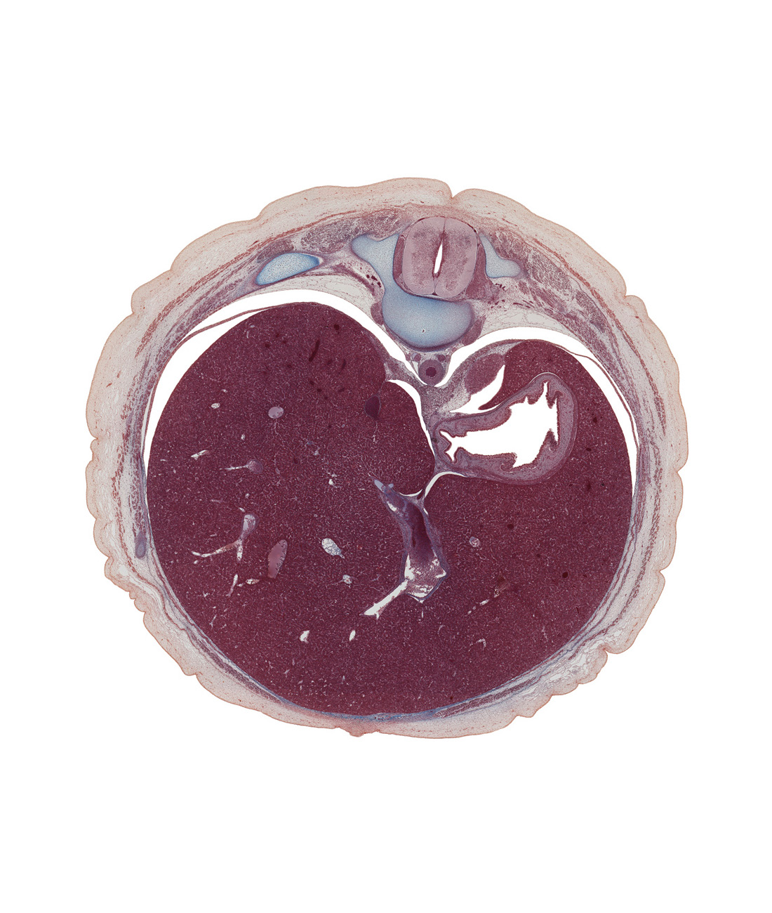 T-10 spinal ganglion, advehente vein, anterior rectus sheath, aorta, aponeurosis of external abdominal oblique muscle, cephalic edge of suprarenal gland, dorsal funiculus, dorsal median septum, ductus venosus, greater splanchnic nerve, inferior vena cava, lateral funiculus, left lobe of liver, lumen of body of stomach, neural arch of T-10 vertebra, pedicle, pleural recess, ramus of lesser splanchnic nerve, rectus abdominis muscle, right lobe of liver, serratus posterior inferior muscle, sympathetic trunk, transverse process, ventral mesogastrium (lesser omentum)