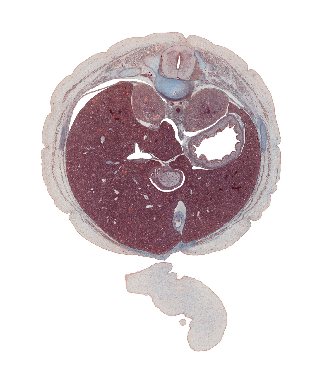 T-11 spinal ganglion, amnion, aorta, azygos vein, cephalic part of pyloric antrum of stomach, dorsal mesogastrium, ductus venosus, greater curvature of stomach, greater sac, hepatic portal vein, inferior vena cava, latissimus dorsi muscle, lumen of body of stomach, mucoid connective tissue, rectus abdominis muscle, rib 11, spleen, suprarenal gland, ventral mesogastrium (lesser omentum)