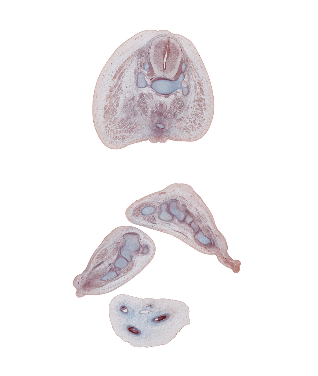 S-3 / S-4 interganglion region, anococcygeal raphe, calcaneum, coccygeus muscle, cuboid, dorsal surface of left foot, fibularis longus and fibularis brevis tendons, flexor digitorum brevis muscle, flexor digitorum longus tendon, gluteus maximus muscle, lower edge of lateral malleolus of fibula, metatarsal 4, plantar aponeurosis, plantar surface of left foot, plantar surface of right foot, quadratus plantae muscle, sympathetic trunk, tip of coccyx