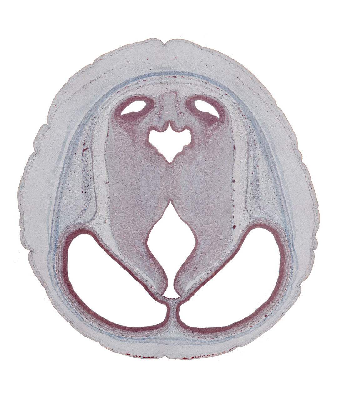arteries in pia mater, blind sack of cerebral aqueduct, cerebral aqueduct (mesocoele), dorsal thalamus, dural limiting membrane, inferior colliculus, mesencephalon (tegmentum), osteogenic layer, roof of third ventricle, subcutaneous tissue, sulcus dorsalis, sulcus medius, superior medullary vellum region, temporal lobe region of cerebral hemisphere, third ventricle, venous plexus(es)