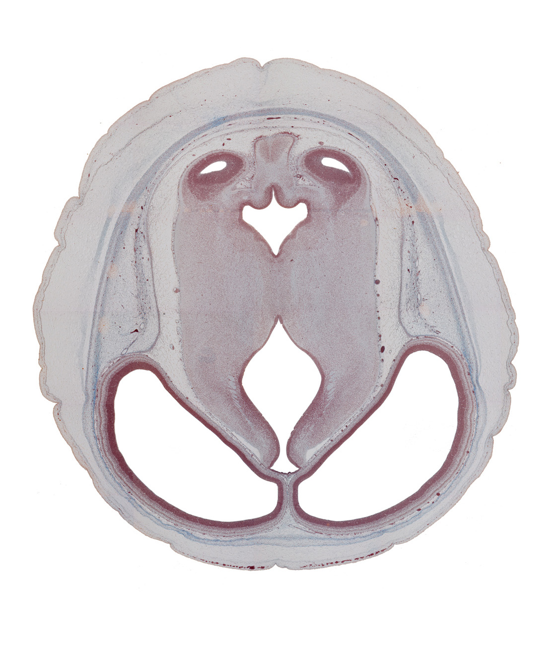 dorsal thalamus, habenular region, hypothalamic sulcus, inferior colliculus, median sulcus, parietal lobe region of cerebral hemisphere, subarachnoid space, sulcus dorsalis, sulcus limitans, vascular plexus, ventral thalamus, vermis of cerebellum (metencephalon)