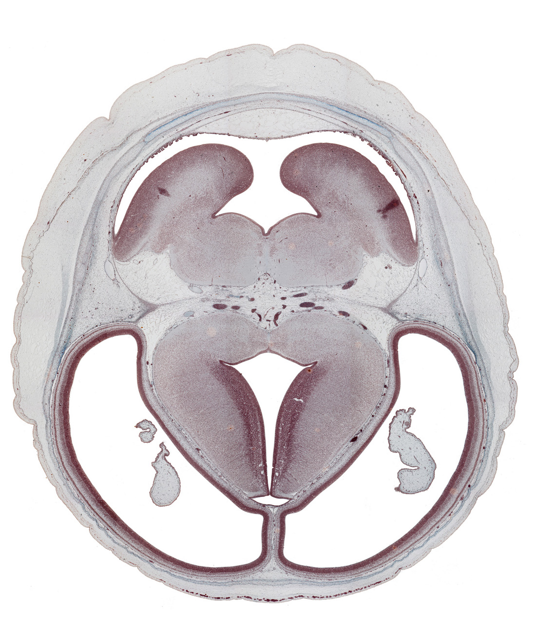 basis pedunculi of pons region (metencephalon), choroid plexus, dorsal thalamus, dural band for tentorium cerebelli, external germinal area, hypothalamic sulcus, intraventricular cerebellum, loose connective tissue space, mesencephalic artery, pons region (metencephalon), rhombencoel (fourth ventricle), subarachnoid space, subcutaneous vascular plexus, superior cerebellar artery, surface ectoderm, trochlear nerve (CN IV), ventral thalamus