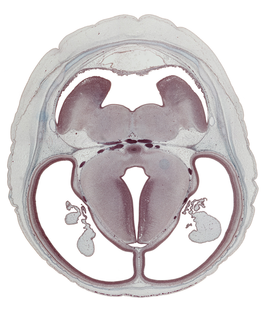 basilar artery, basis pedunculi of pons region (metencephalon), decussation, diverticulum, dorsal thalamus, hypothalamic sulcus, inferior sagittal sinus, mamillary body, median sulcus, oculomotor nerve (CN III), posterior cerebral artery, posterior communicating artery, roof of rhombencoel (fourth ventricle), subarachnoid space, sulcus dorsalis, sulcus limitans, superior cerebellar artery, superior sagittal sinus, trochlear nerve (CN IV), ventral thalamus