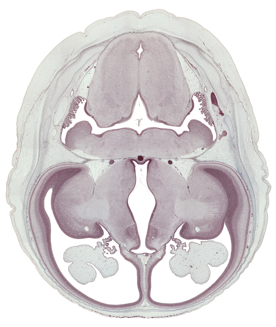 anterior inferior cerebellar artery, basilar artery, basis pedunculi of pons region (metencephalon), caudate nucleus, central canal, choroid fissure, choroid plexus, flocculus of cerebellum, hypothalamic sulcus, hypothalamus, insula of cerebral hemisphere, internal capsule, internal cerebellar swelling, medulla oblongata, posterior inferior cerebellar artery, rhombencoel (fourth ventricle), spinal tract of trigeminal nerve (CN V), temporal pole of cerebral hemisphere, third ventricle, transverse sinus, vascular plexus