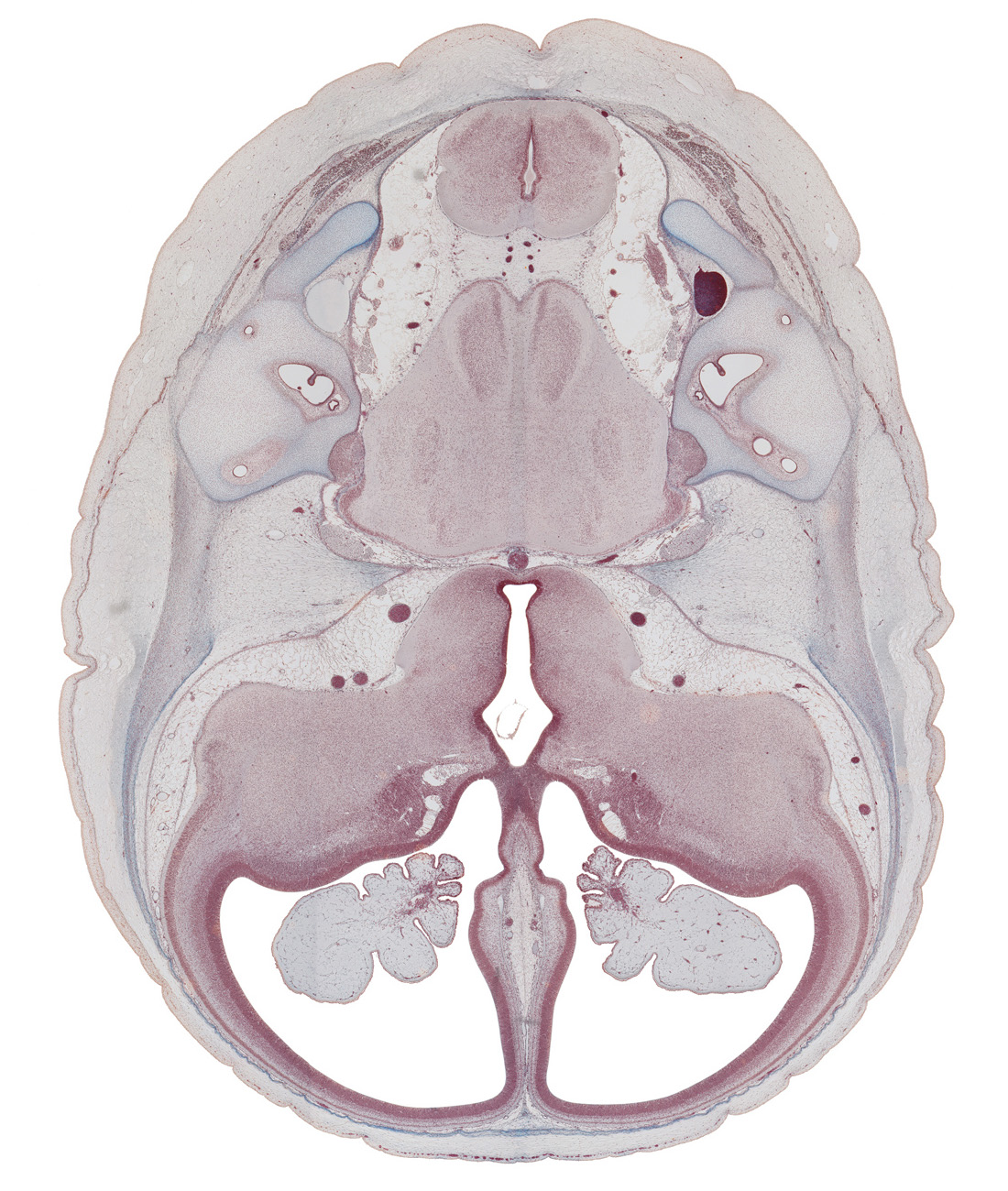 anterior inferior cerebellar artery, anterior semicircular duct, basilar artery, choroid plexus, facial nerve (CN VII), hippocampus, internal acoustic meatus, internal carotid artery, junction of common limb and utricle, lateral ventricle, oculomotor nerve (CN III), optic groove, optic tract, otic capsule, posterior inferior cerebellar artery, region of cervical flexure, root of trigeminal nerve (CN V), semispinalis capitis muscle, superior sagittal sinus, trochlear nerve (CN IV), vestibulocochlear nerve (CN VIII)
