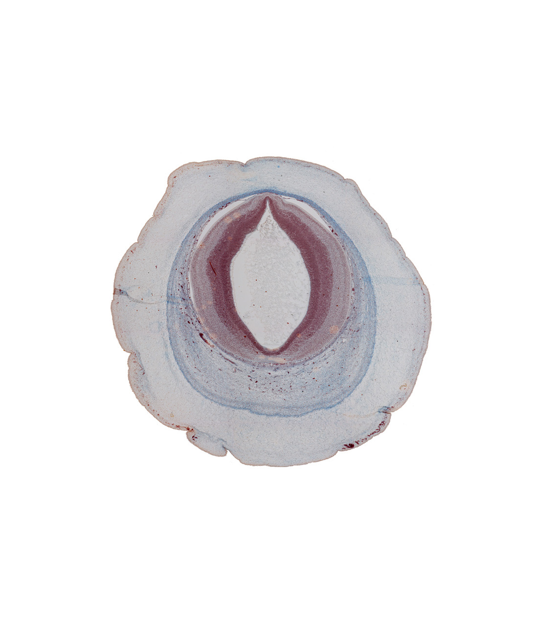 cerebral aqueduct (mesocoele), dural limiting membrane, loose connective tissue, mesencephalon (tectum), osteogenic layer, subarachnoid space, subcutaneous vascular plexus, surface ectoderm, venous plexus(es)