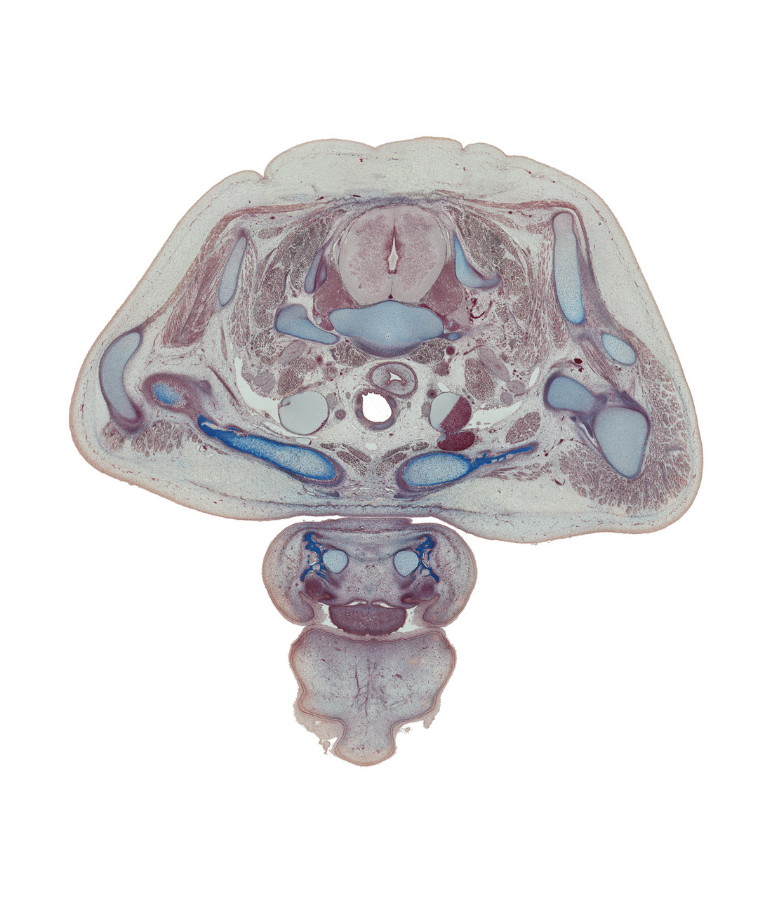 C-8 spinal ganglion, central canal, clavicle, deltoid muscle, dorsal median septum, lower cervical sympathetic ganglion, lower trunk of brachial plexus (C-8, T-1), platysma muscle, retro-esophageal space, rhomboid minor muscle, right recurrent laryngeal nerve, scalene anterior muscle, scalenius medius muscle, superior belly of omohyoid muscle, supraspinatus muscle, trapezius muscle, upper lip, vagus nerve (CN X), ventral median septum