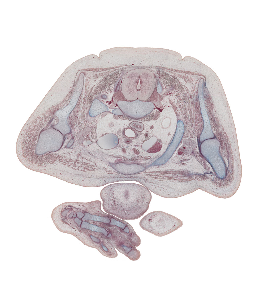 T-1 spinal ganglion, T-1 spinal nerve, axillary artery, axillary lymph sac, coracoid process of scapula, distal interphalangeal joint of digit 3 (middle finger), edge of left pleural cavity, edge of right pleural cavity, esophagus, extensor tendons, glenohumeral joint, interosseus muscle, left brachiocephalic vein, left lobe of thymus gland, manubrium of sternum, proximal interphalangeal joint of digit 2, rhomboid minor muscle, rib 1, right brachiocephalic vein, trapezius muscle, trapezoid, white matter