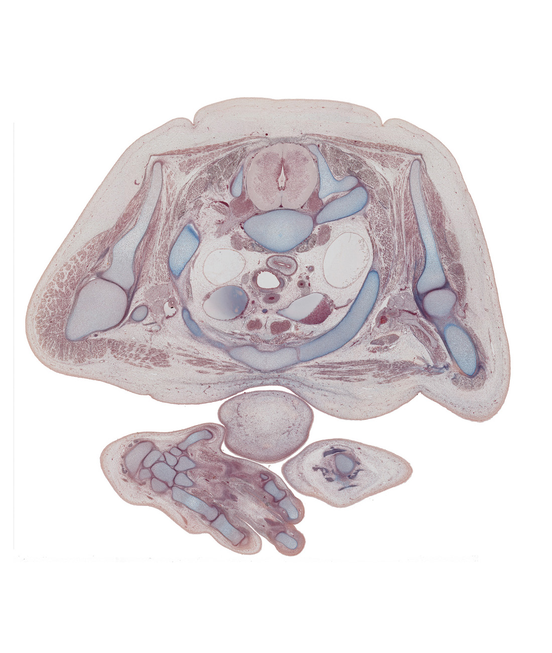 T-1 spinal ganglion, brachiocephalic artery, capitate, centrum of T-1 vertebra, distal interphalangeal joint of digit 2 (index finger), distal phalynx of digit 3 (middle finger), esophagus, facial muscle layer, left brachiocephalic vein, left pleural cavity, left subclavian artery, metacarpophalangeal joint of digit 4 (ring finger), neck of rib 2, pectoralis major muscle, rib 1, right brachiocephalic vein, right lobe of thymus gland, scapula, skin of chin, thenar muscle, trachea, trapezium