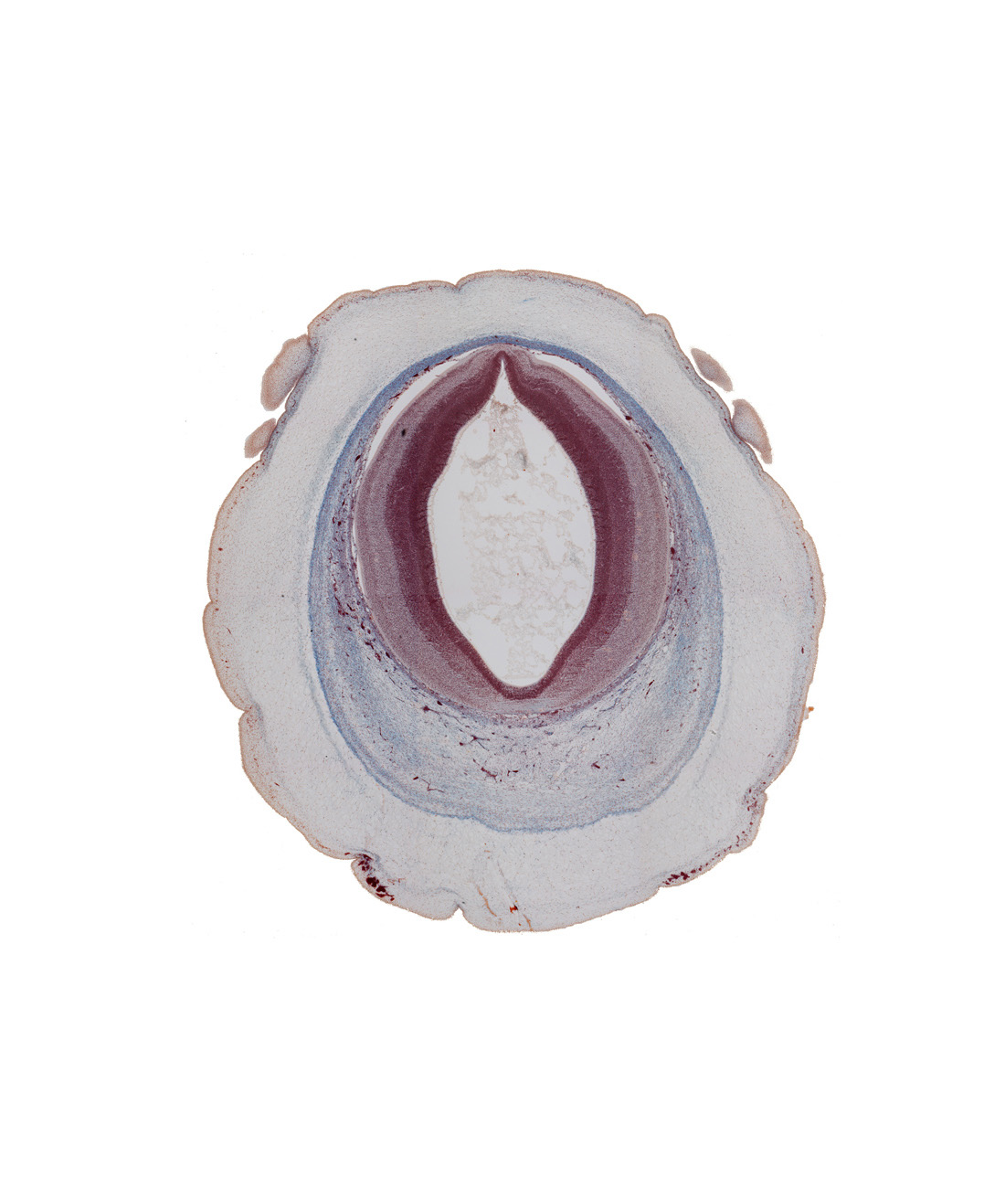 cerebral aqueduct (mesocoele), intermediate zone, loose connective tissue, marginal zone, osteogenic layer, pericranium, roof plate of mesencephalon, subarachnoid space, surface ectoderm, ventricular zone
