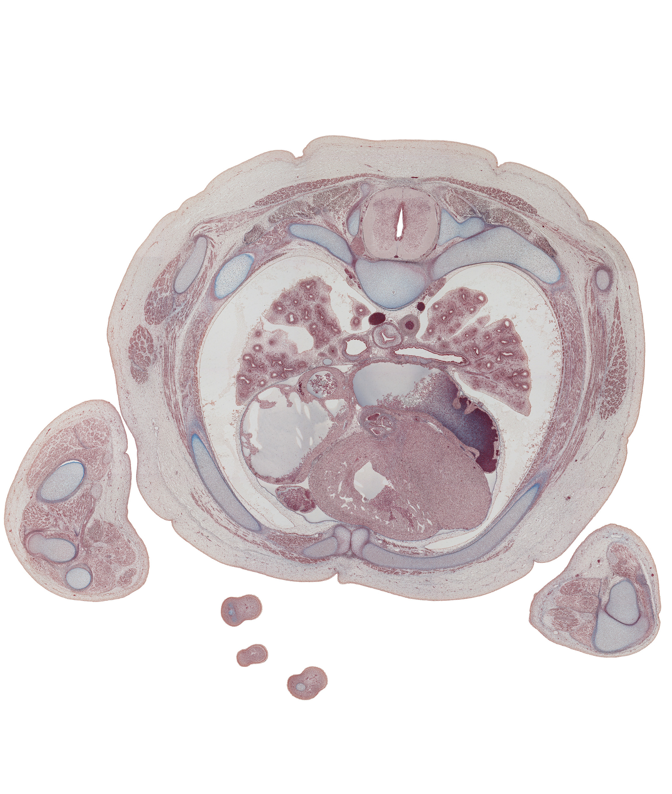 T-4 / T-5 interganglion region, anterior interventricular sulcus, aortic semilunar valve, azygos vein, caudal edge of scapula, edge of distal phalynx of digit 4 (ring finger), external intercostal muscle(s), horizontal fissure, interatrial septum, internal intercostal muscle(s), left atrium, left coronary artery, lower lobe of left lung, lower lobe of right lung, middle lobe of right lung, oblique fissure, rib 4 (costal cartilage), rib 5, serratus anterior muscle, sinus venarum, superior lingular segmental bronchus of left lung, upper lobe of left lung, upper lobe of right lung
