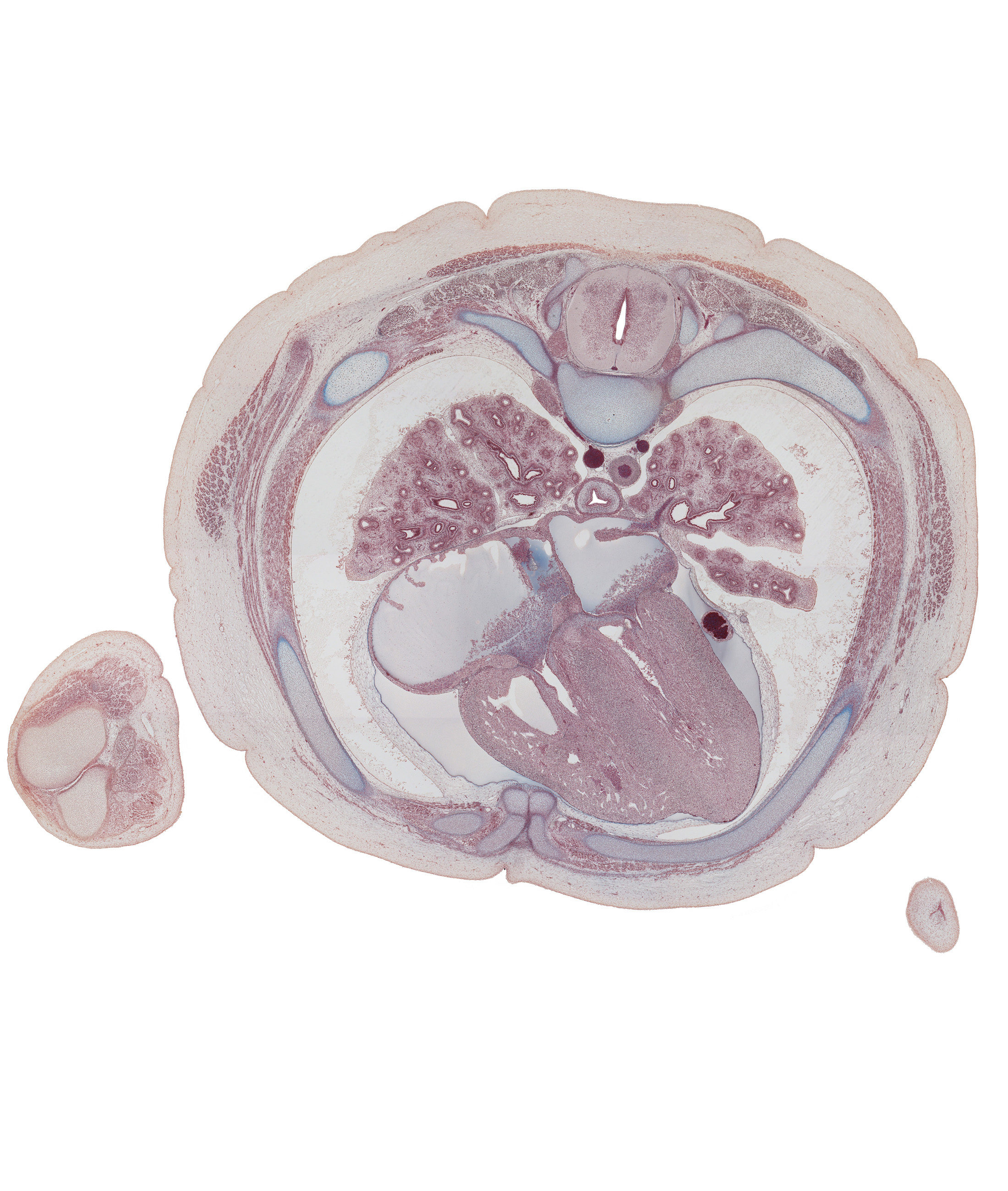 T-5 spinal ganglion, anterior papillary muscle in right ventricle, caudal edge of left auricle, dorsal median septum, edge of elbow, hemisternum, humerus, interatrial septum, left lower pulmonary vein, lower lobe of left lung, lower lobe of right lung, membranous part of interventricular septum, middle lobe of right lung, oblique fissure, pia mater on surface of spinal cord, rib 5 (costal cartilage), rib 6, rib 6 (costal cartilage), right atrium, sympathetic trunk, trapezius muscle, ulna, upper lobe of left lung, ventral median septum