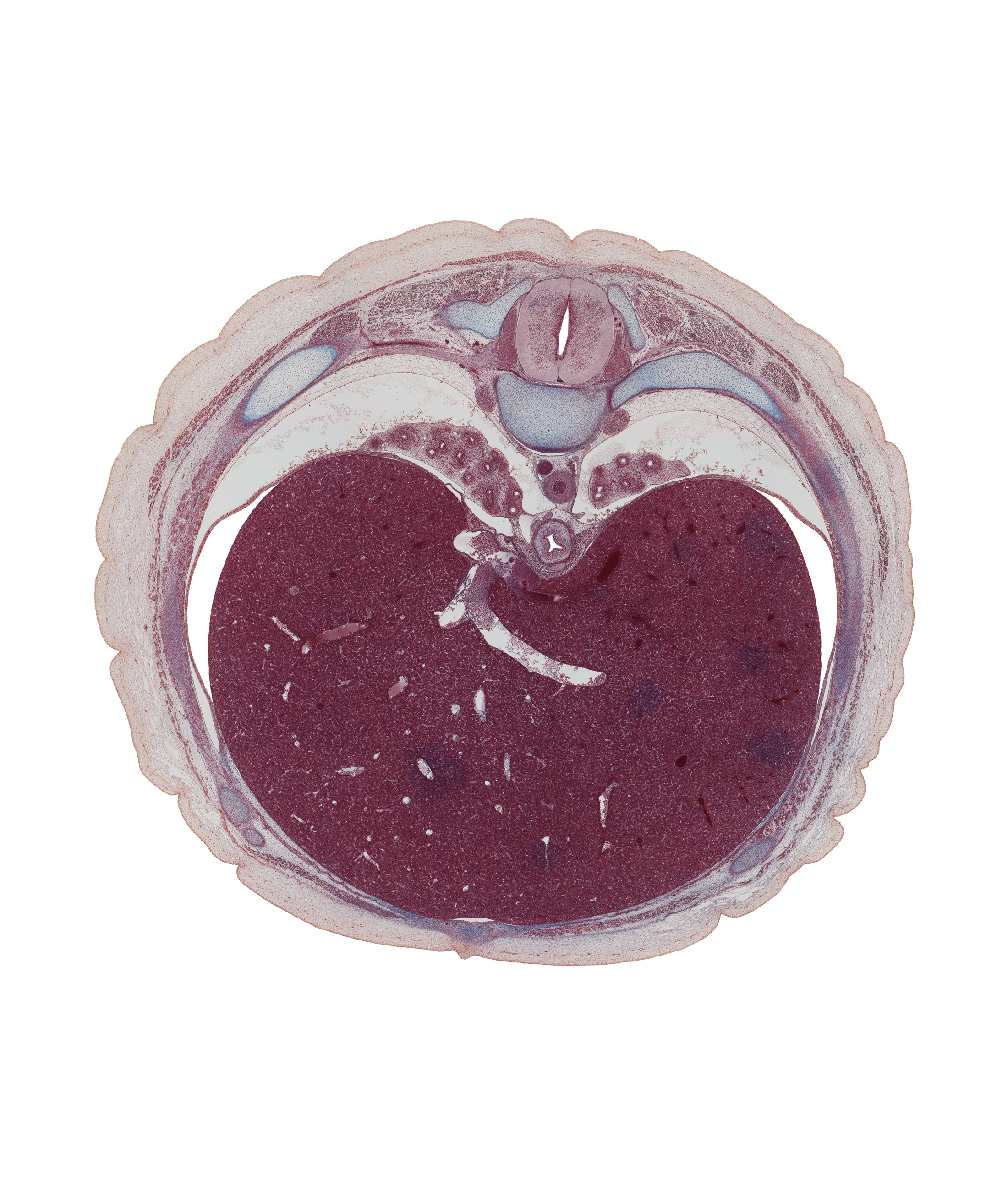 T-8 spinal ganglion, anterior spinal artery, azygos vein, common hepatic vein, costal margin, dorsal horn of grey matter, dorsal meso-esophagus, inferior vena cava, junction of ductus venosus and inferior vena cava, lateral horn of grey matter, left hepatic vein, left lobe of liver, linea alba, lower lobe of left lung, lower lobe of right lung, pulmonary ligament, rectus abdominis muscle, rib 9, right hepatic vein, serratus anterior muscle, sympathetic trunk, ventral horn of grey matter