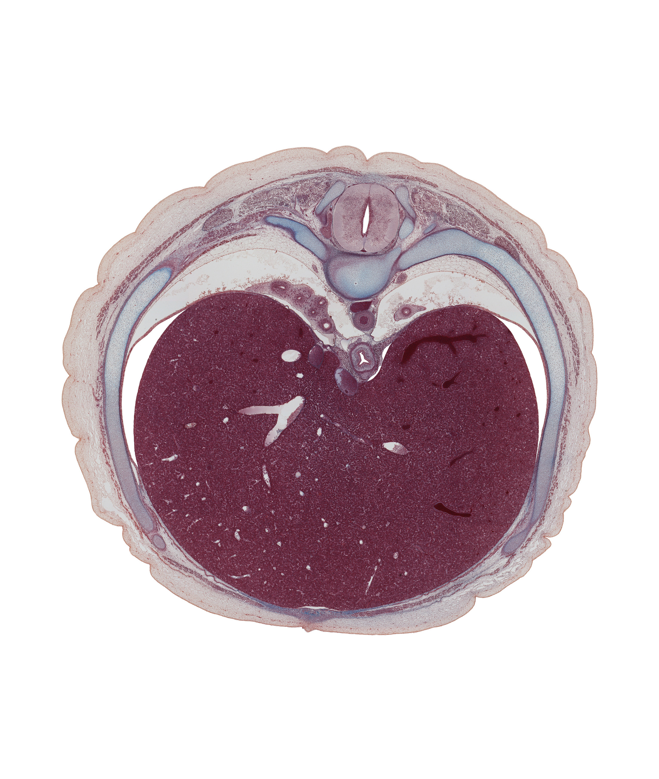T-8 / T-9 interganglion region, T-8 / T-9 intervertebral disc, anterior gastric nerve (CN X), caudal edge of left lung, central canal of spinal cord, diaphragm, dorsal horn of grey matter, ductus venosus, efferent hepatic vein, esophageal hiatus in diaphragm, head of rib 9, iliocostalis muscle, inferior vena cava, left hepatic vein tributary (revehente vein), longissimus muscle, muscular part of diaphragm, neural arch, peritoneal cavity, posterior gastric nerve (CN X), rib 9, right hepatic vein, sympathetic trunk, transversospinalis muscle