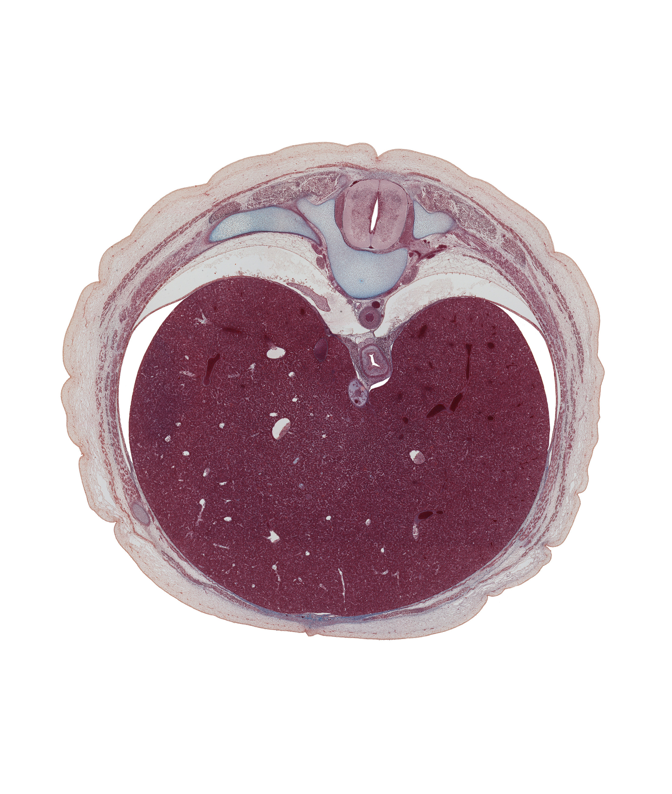 T-9 spinal ganglion, T-9 spinal nerve, aorta, centrum of T-9 vertebra, diaphragm, dorsal meso-esophagus, ductus venosus, efferent hepatic vein, inferior vena cava, latissimus dorsi muscle, left lobe of liver, lung, right, parietal pleura, peritoneal cavity, pleural recess, right lobe of liver, sympathetic trunk, thoracolumbar fascia, trapezius muscle