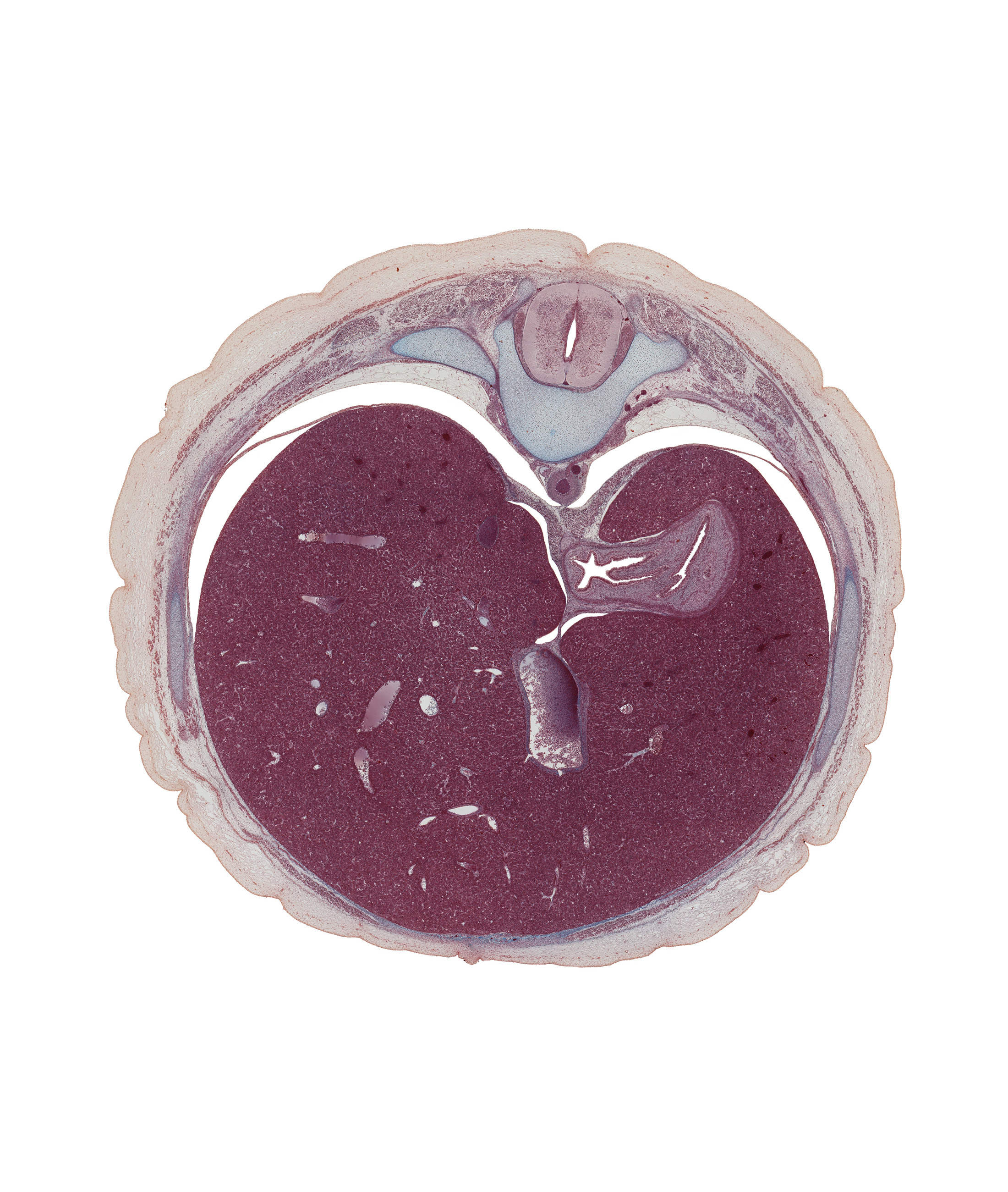 T-10 intercostal nerve, T-10 spinal ganglion, anterior rectus sheath, aorta, cardiac portion of stomach, ductus venosus, external abdominal oblique muscle, fundus of stomach, greater sac, inferior vena cava, junction of esophagus and stomach, latissimus dorsi muscle, left lobe of liver, linea alba, pleural recess, rectus abdominis muscle, rib 10, right crus of diaphragm, right lobe of liver, sympathetic trunk, ventral mesogastrium (lesser omentum)