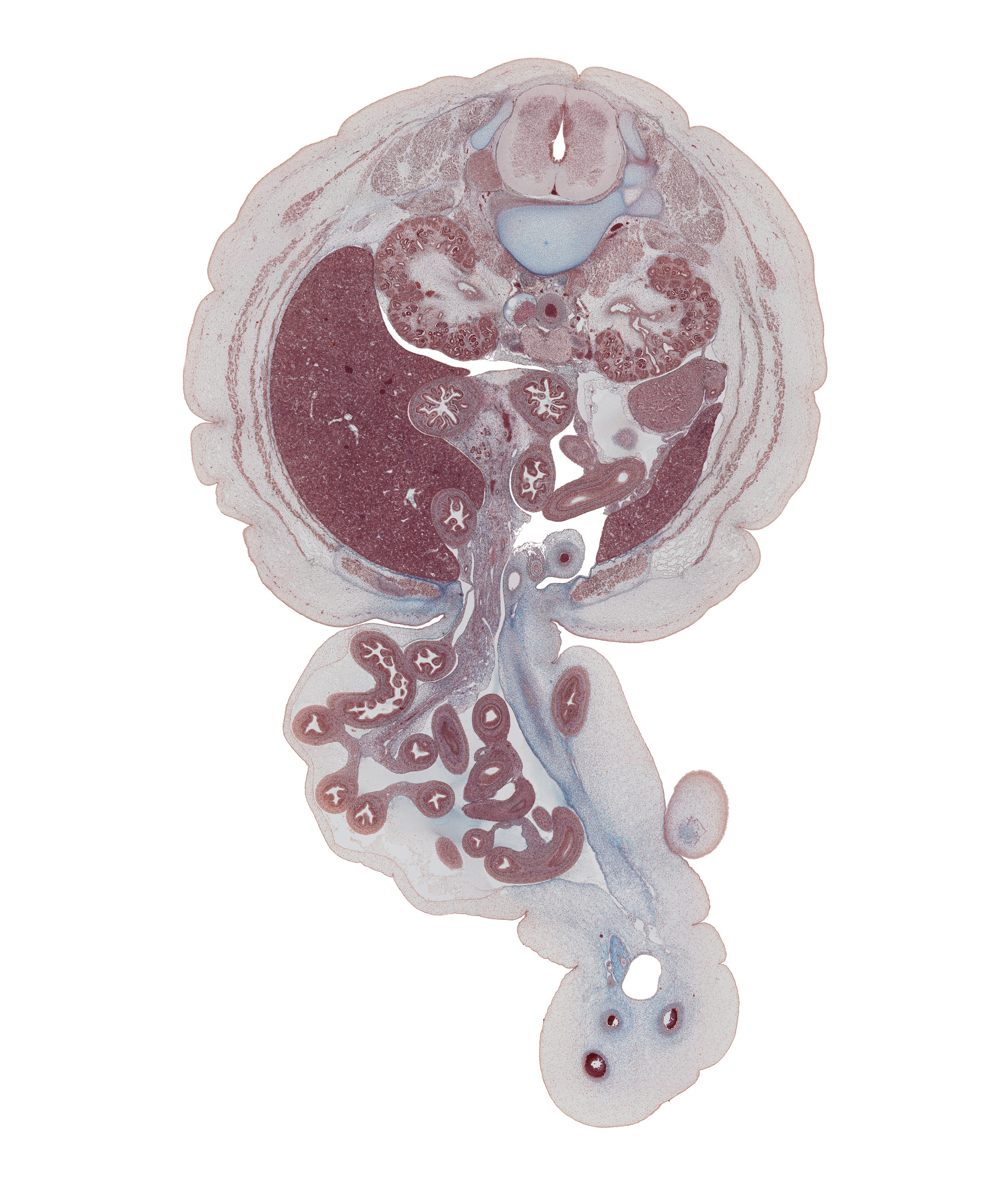 L-1 / L-2 interganglion region, allantoic vesicle(s), aorta, ascending part of duodenum, caudal edge of stomach, cecum, colon, descending part of duodenum, edge of left knee, external abdominal oblique muscle, herniated intestines, inferior vena cava, internal abdominal oblique muscle, jejunum, left lobe of liver, left umbilical artery, mesocolon, middle major calyx, minor calyx, pancreatic duct, renal pelvis, right umbilical artery, testis, transversus abdominis muscle, umbilical cord, umbilical vein, umbilical vesicle stalk