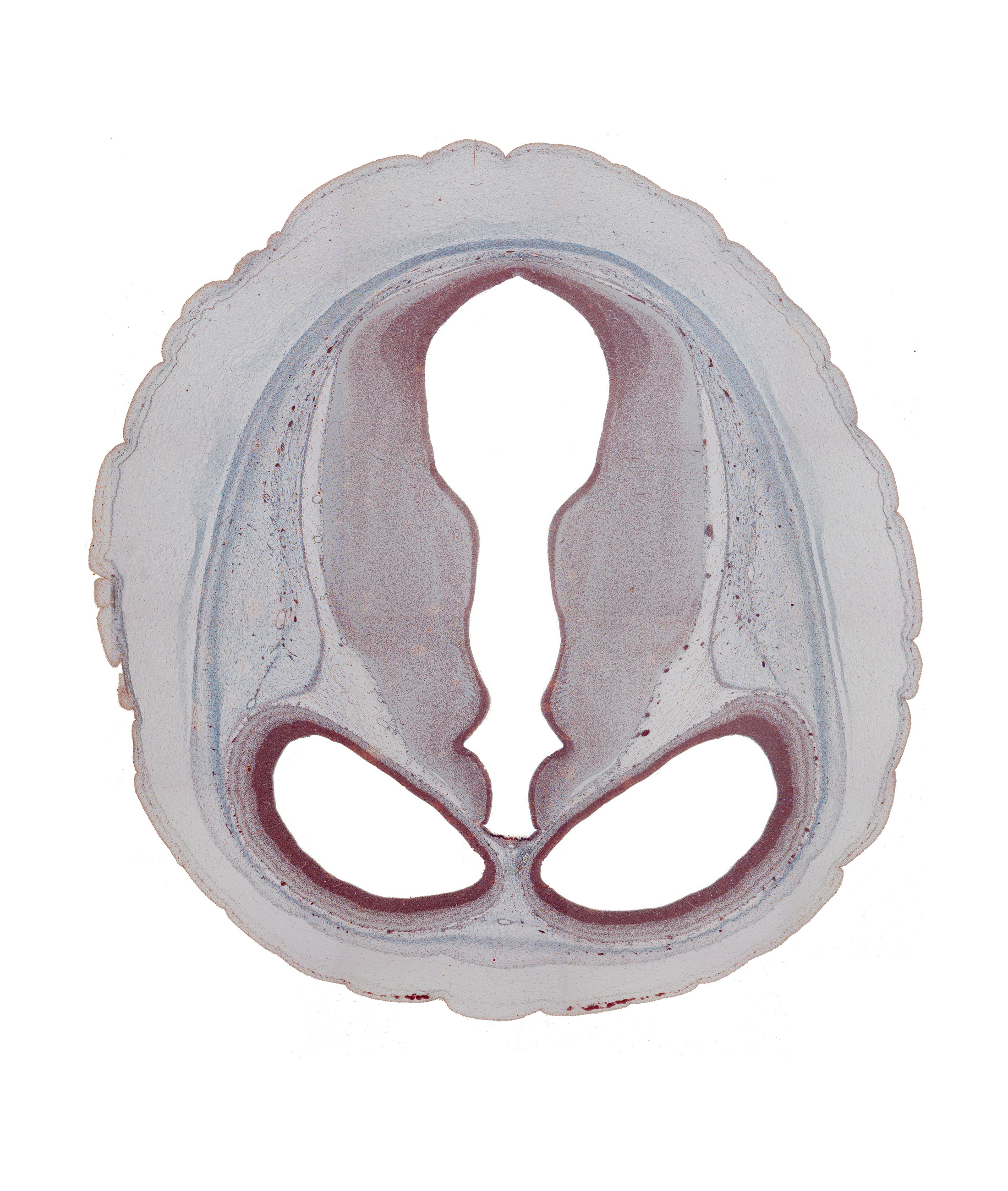 cerebral aqueduct (mesocoele), cerebral hemisphere (neopallium), collicular ridge (tectum), diencephalon, dorsal thalamus (caudal part), dural limiting membrane, ectomeninx, endomeninx, habenular region, hypothalamic sulcus, junction of cerebral aqueduct and third ventricle, lateral ventricle, mesencephalon, osteogenic layer, subarachnoid space, third ventricle