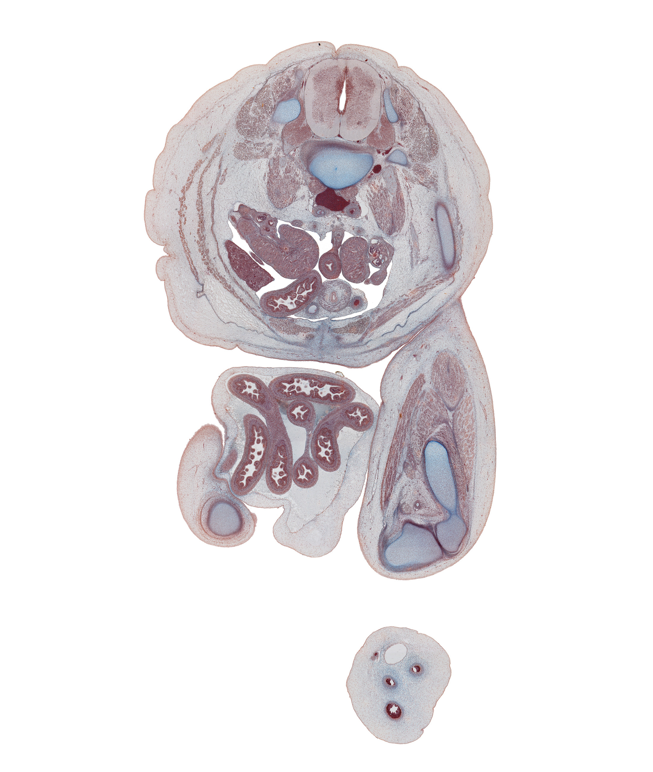 L-3 / L-4 intervertebral disc, L-3 spinal ganglion, colon, epididymis, femoral nerve, femur, herniated intestines, inferior vena cava, jejunum, knee joint, lateral condyle of femur, left common iliac artery, linea alba, medial condyle of tibia, mesocolon, notochord, popliteal artery, popliteal fossa, psoas major muscle, rectus femoris muscle, sartorius muscle, sympathetic trunk, testis, umbilical coelom, umbilical cord, ureter, urinary bladder, vas deferens, vastus lateralis muscle, vastus medialis muscle