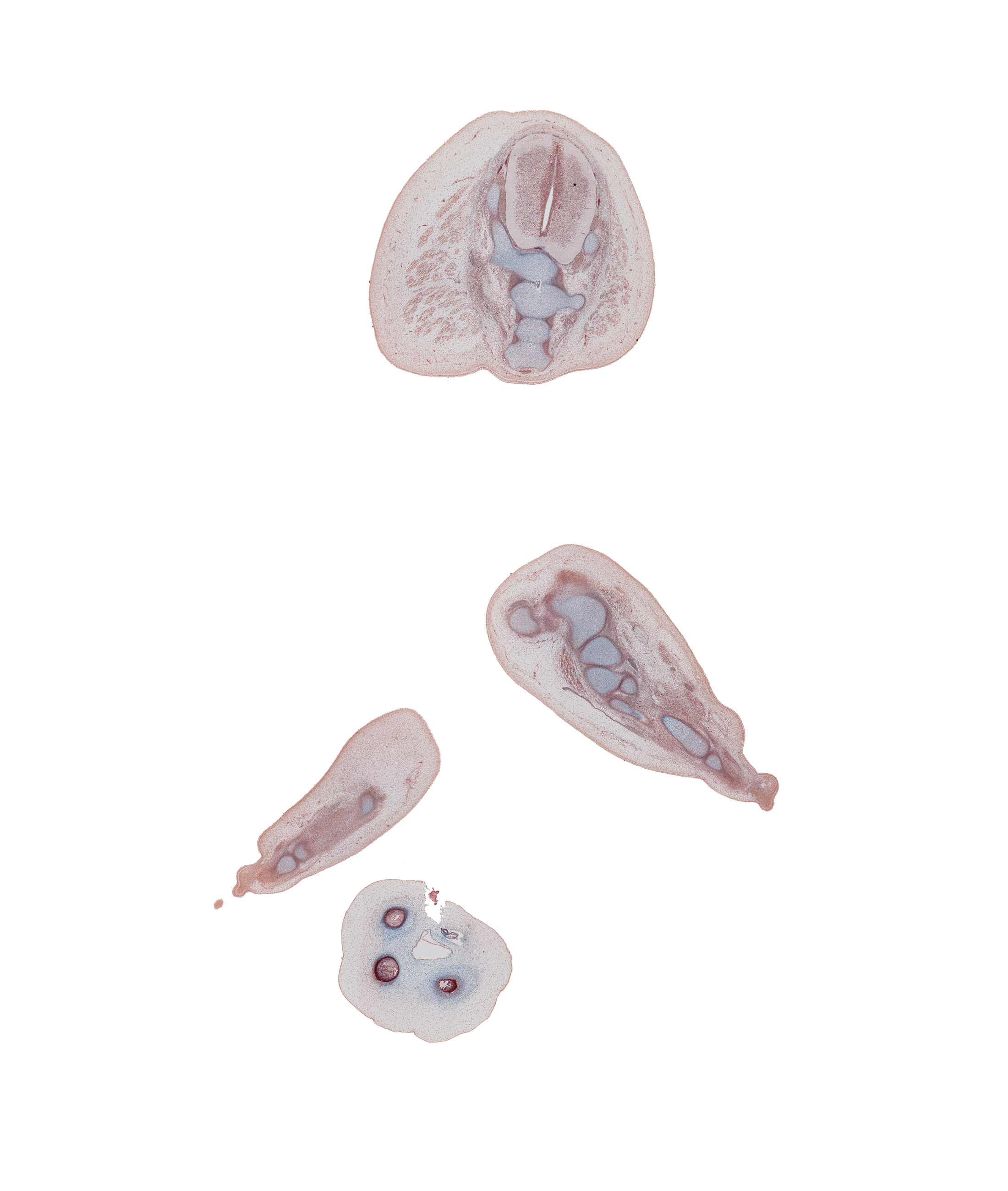 Co-1 spinal nerve, S-5 spinal ganglion, S-5 vertebra, coccyx, digit 5 (foot), gluteus maximus muscle, metatarsophalangeal joint of digit 5 (foot), neural arch, plantar surface of left foot, right foot, tuberosity of metatarsal 5