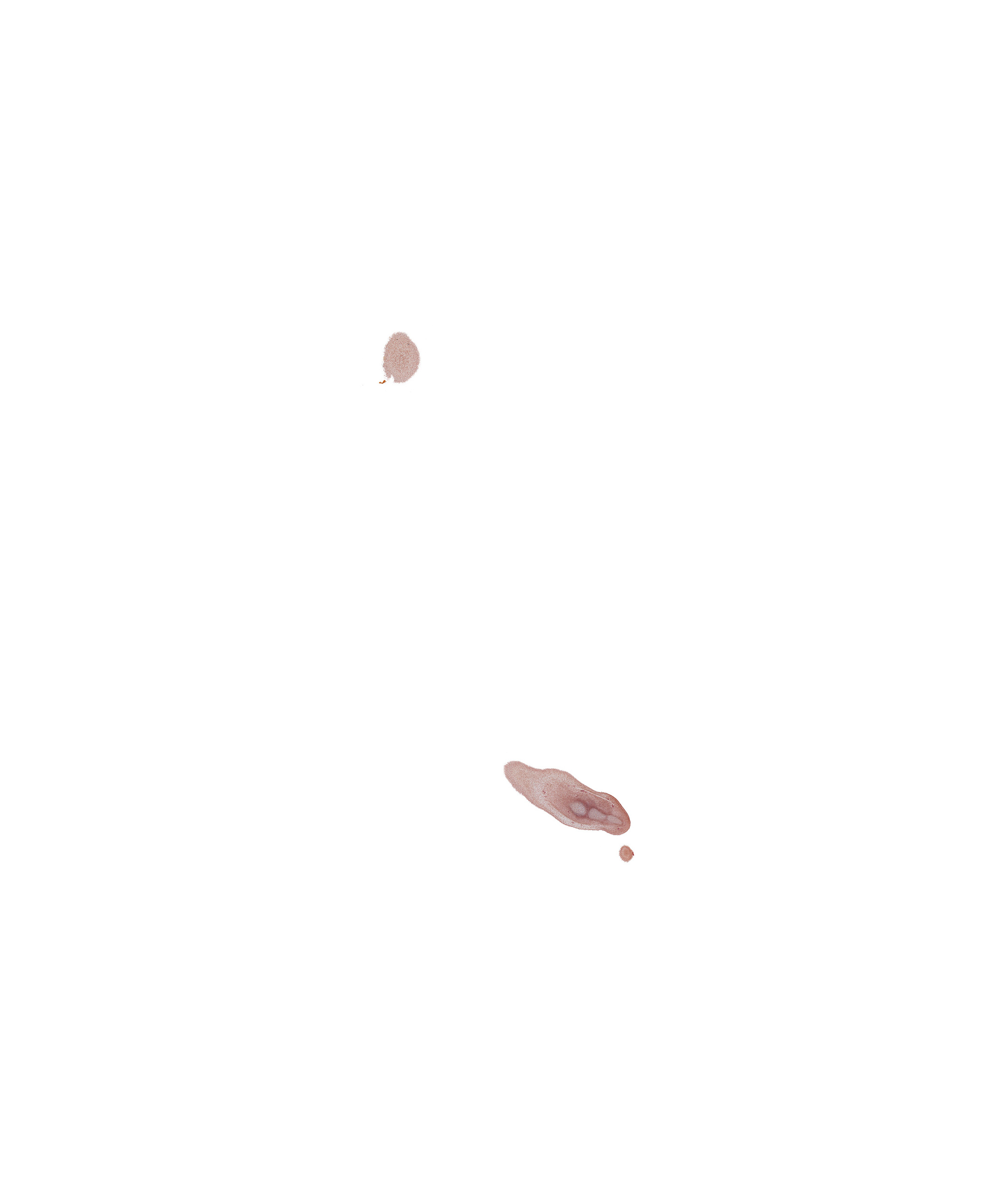 caudal edge of embryo, edge of right foot, surface ectoderm