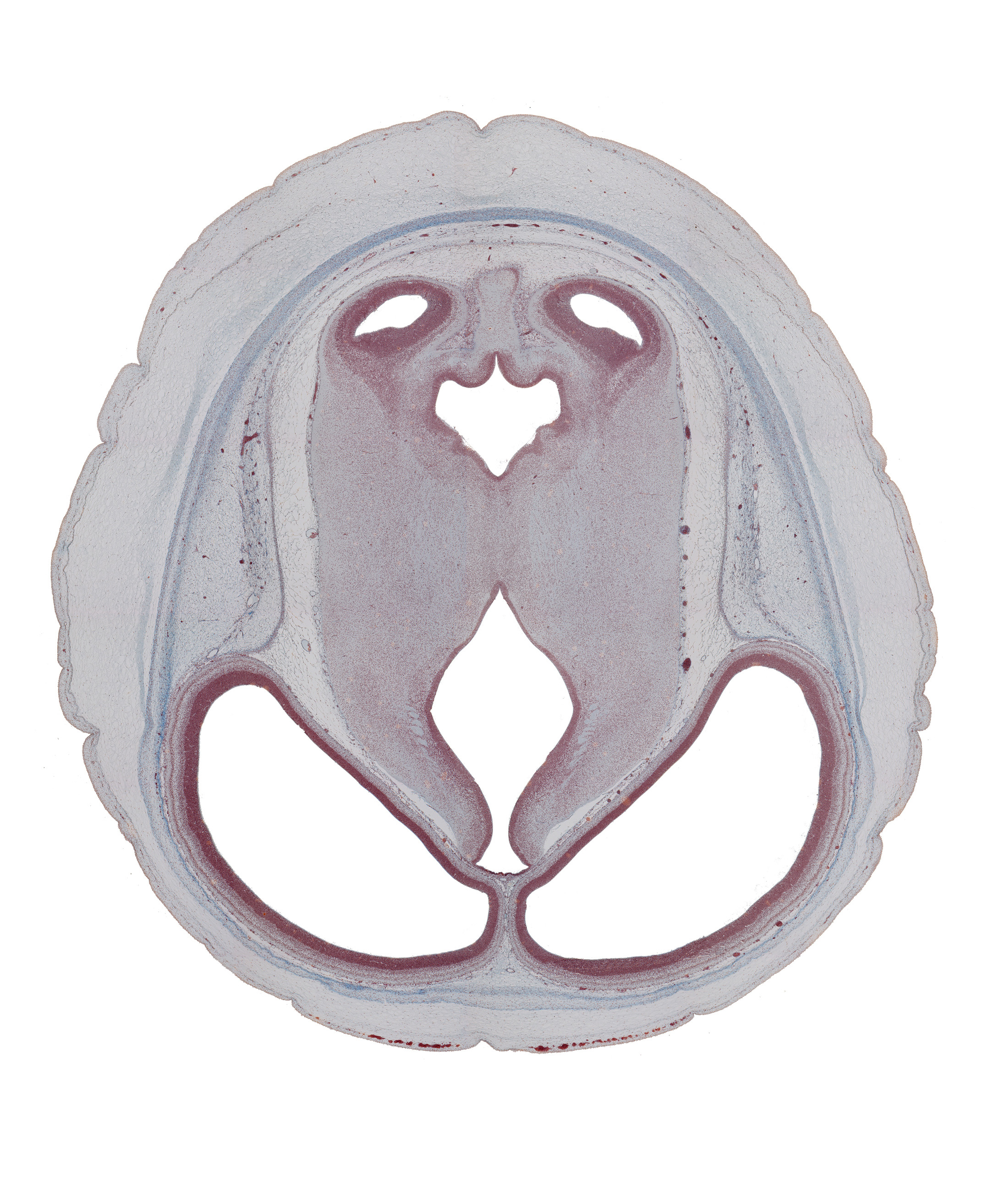 arteries in pia mater, blind sack of cerebral aqueduct, cerebral aqueduct (mesocoele), dorsal thalamus, dural limiting membrane, inferior colliculus, mesencephalon (tegmentum), osteogenic layer, roof of third ventricle, subcutaneous tissue, sulcus dorsalis, sulcus medius, superior medullary vellum region, temporal lobe region of cerebral hemisphere, third ventricle, venous plexus(es)