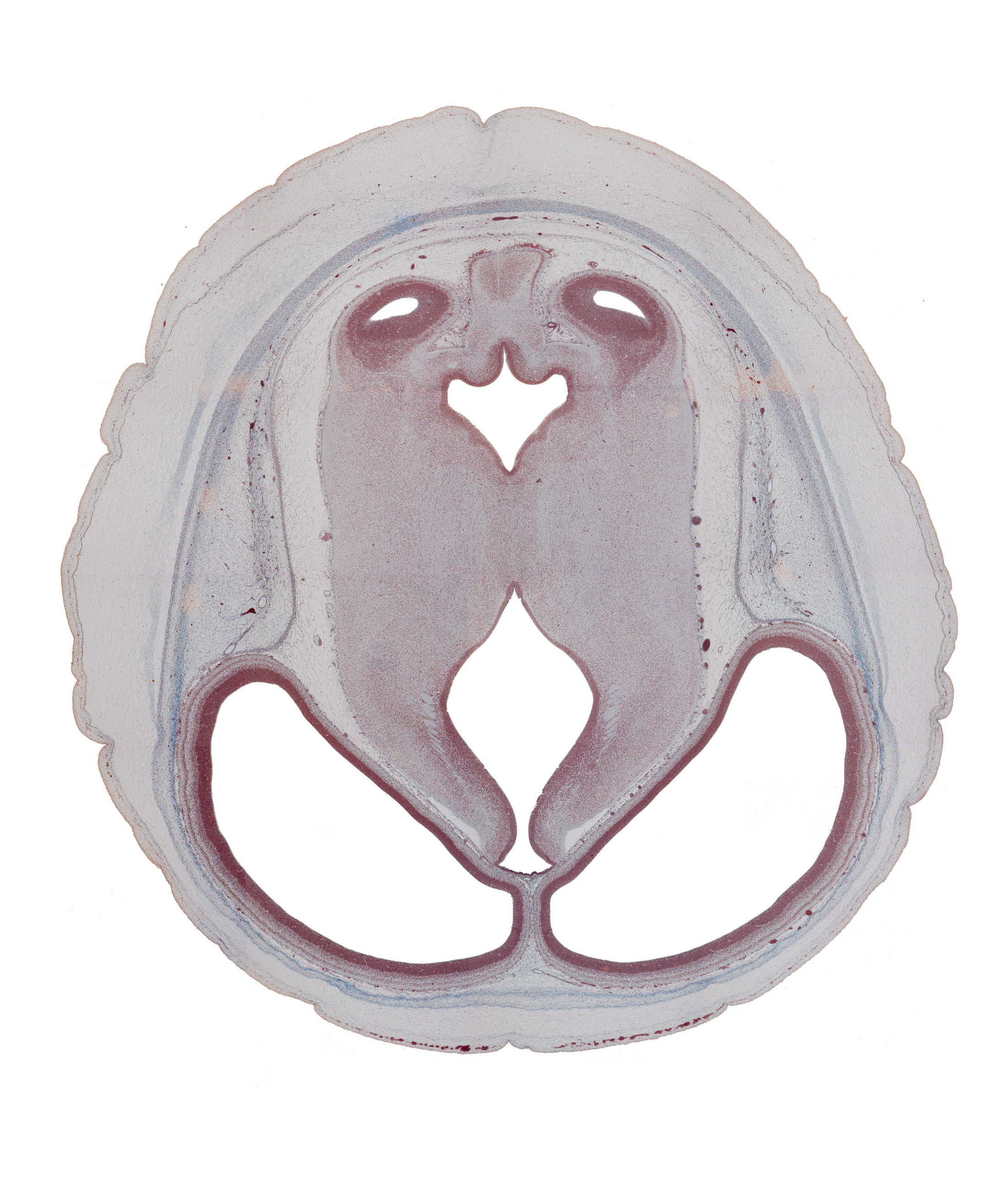 dorsal thalamus, habenular region, hypothalamic sulcus, inferior colliculus, median sulcus, parietal lobe region of cerebral hemisphere, subarachnoid space, sulcus dorsalis, sulcus limitans, vascular plexus, ventral thalamus, vermis of cerebellum (metencephalon)