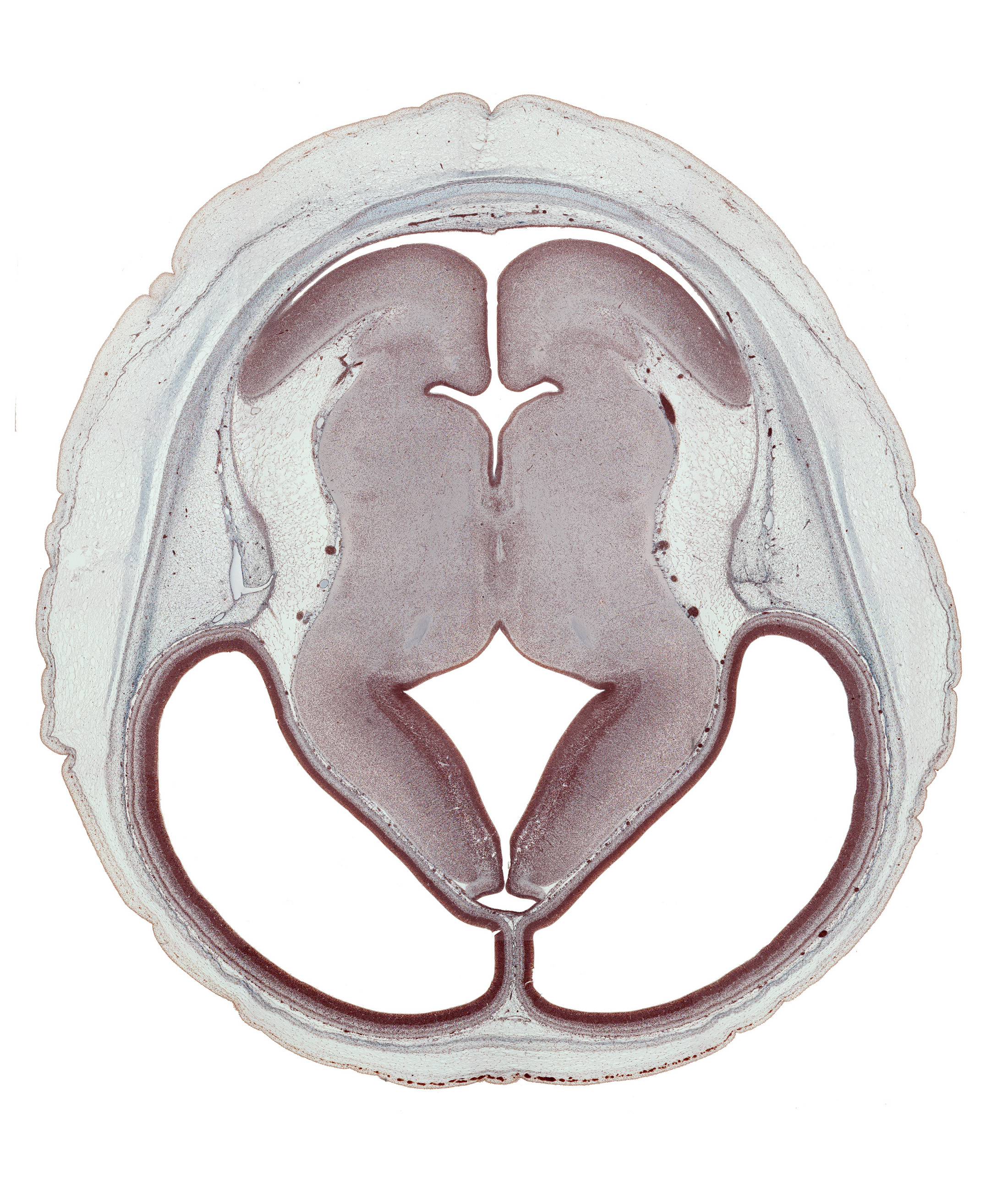 alar plate(s), cerebral hemisphere, dorsal thalamus, dural venous sinus, external germinal area, flocculus of cerebellum, hypothalamic sulcus, isthmus of rhombencephalon, lateral ventricle, median sulcus, membrane area of roof of rhombencoel (fourth ventricle), parietal lobe region, rhombencoel (fourth ventricle), roof of diencephalon, sensory decussation, subarachnoid space, subcutaneous tissue, sulcus dorsalis, third ventricle