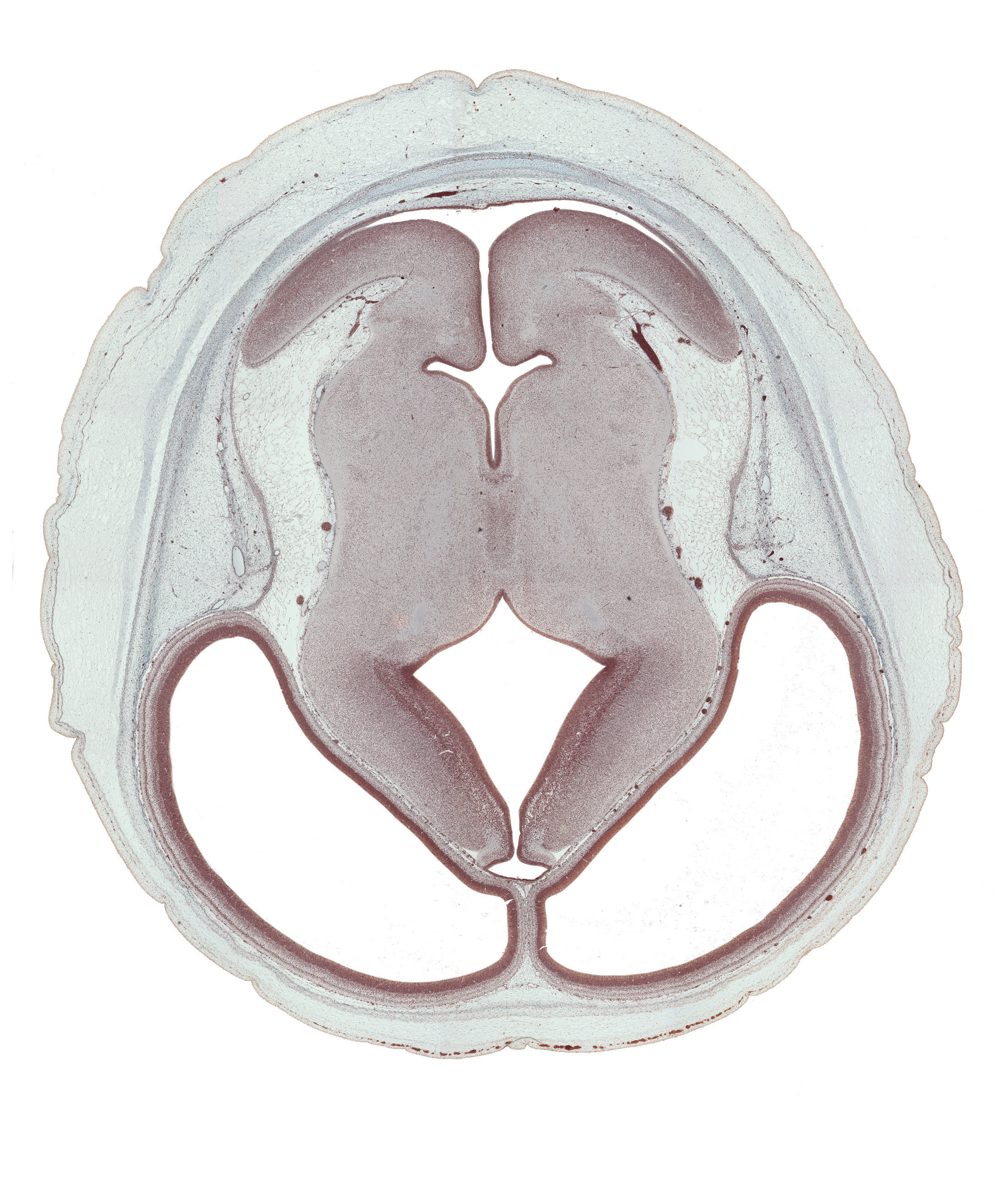 basis pedunculi of pons region (metencephalon), cerebral aqueduct (mesocoele), cerebral hemisphere (neopallium), cortical plate, diencephalic artery, dorsal thalamus, hypothalamic sulcus, intraventricular cerebellum, junction of cerebral aqueduct and rhombencoel (fourth ventricle), median sulcus, mesencephalic artery, rhombencoel (fourth ventricle), roof of third ventricle, sensory decussation, sulcus dorsalis, sulcus medius, superior cerebellar artery, trochlear nerve (CN IV), ventral thalamus