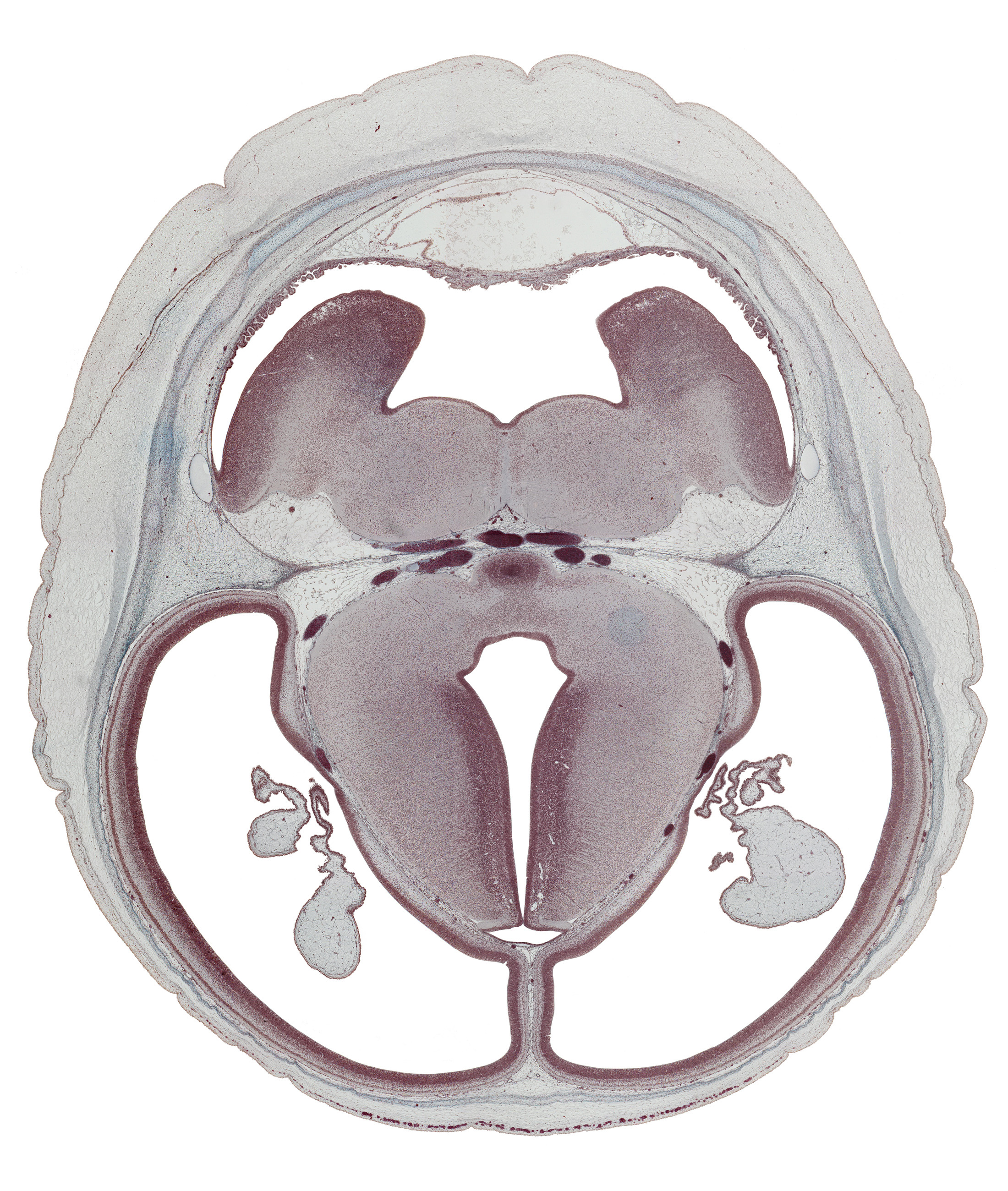 basilar artery, basis pedunculi of pons region (metencephalon), decussation, diverticulum, dorsal thalamus, hypothalamic sulcus, inferior sagittal sinus, mamillary body, median sulcus, oculomotor nerve (CN III), posterior cerebral artery, posterior communicating artery, roof of rhombencoel (fourth ventricle), subarachnoid space, sulcus dorsalis, sulcus limitans, superior cerebellar artery, superior sagittal sinus, trochlear nerve (CN IV), ventral thalamus
