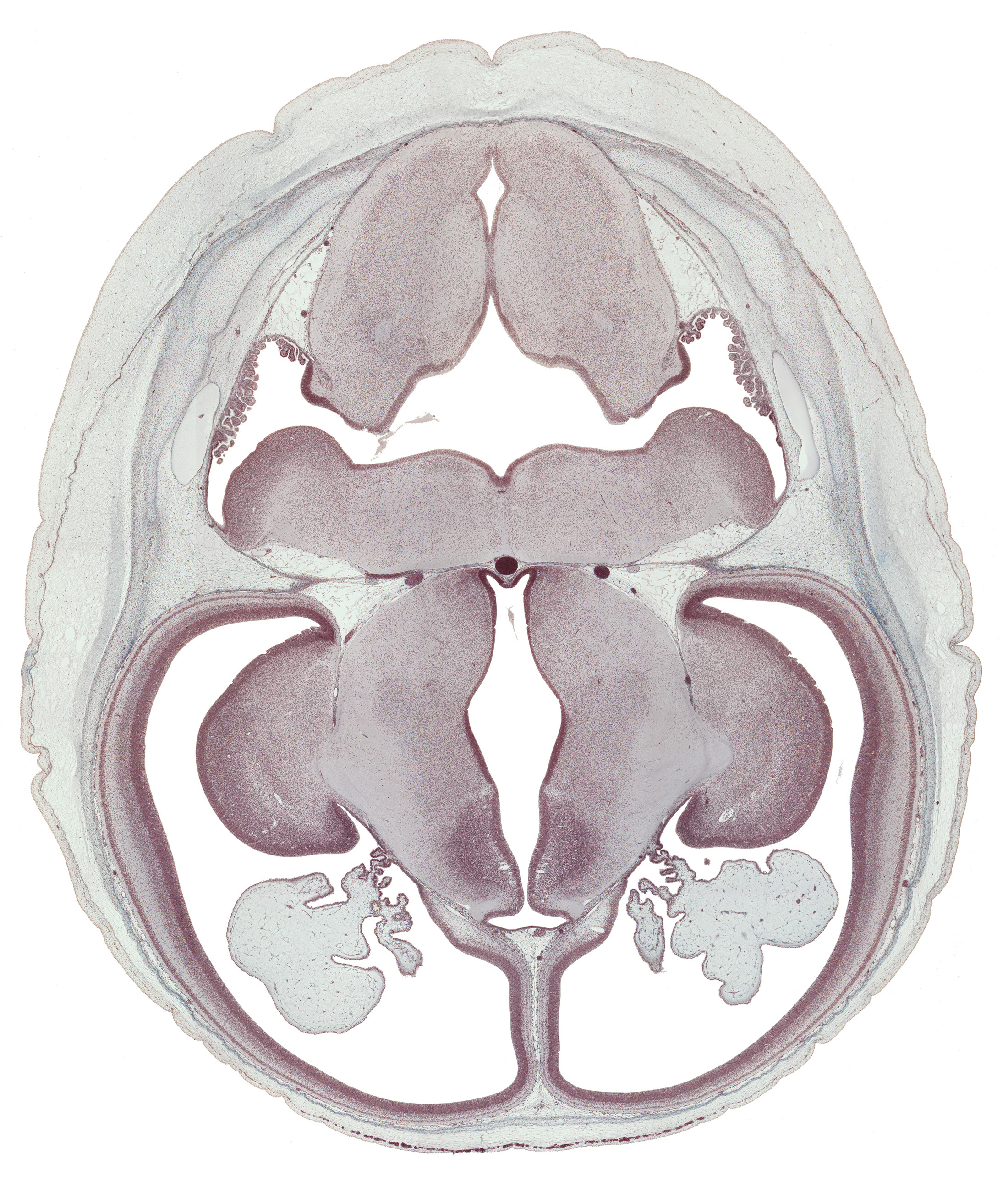 alar plate(s), anterior inferior cerebellar artery, basilar artery, choroid plexus, dorsal thalamus, hypothalamic sulcus, hypothalamus, inferior horn of lateral ventricle, internal capsule, lateral recess of rhombencoel (fourth ventricle), marginal ridge, obex, posterior communicating artery, posterior inferior cerebellar artery, rhombencoel (fourth ventricle), sulcus dorsalis, sulcus medius, third ventricle, ventral thalamus, zona limitans intrathalamica