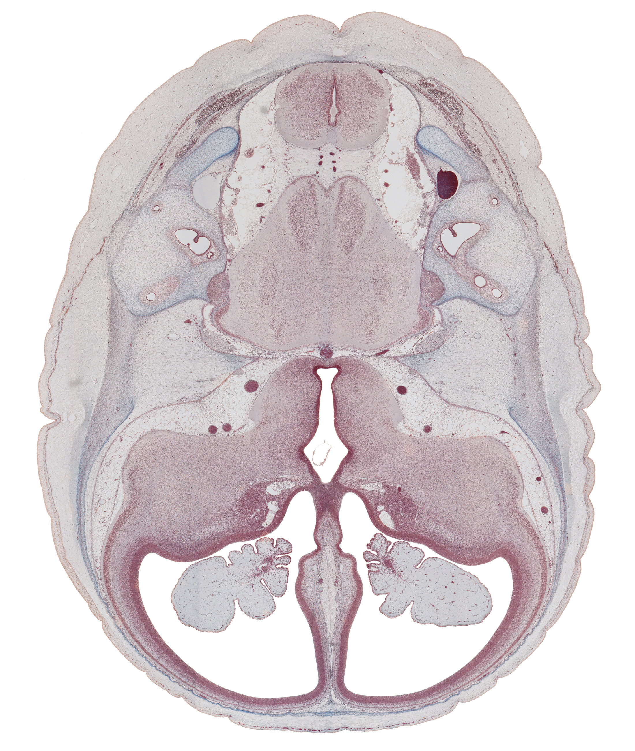 anterior inferior cerebellar artery, anterior semicircular duct, basilar artery, choroid plexus, facial nerve (CN VII), hippocampus, internal acoustic meatus, internal carotid artery, junction of common limb and utricle, lateral ventricle, oculomotor nerve (CN III), optic groove, optic tract, otic capsule, posterior inferior cerebellar artery, region of cervical flexure, root of trigeminal nerve (CN V), semispinalis capitis muscle, superior sagittal sinus, trochlear nerve (CN IV), vestibulocochlear nerve (CN VIII)