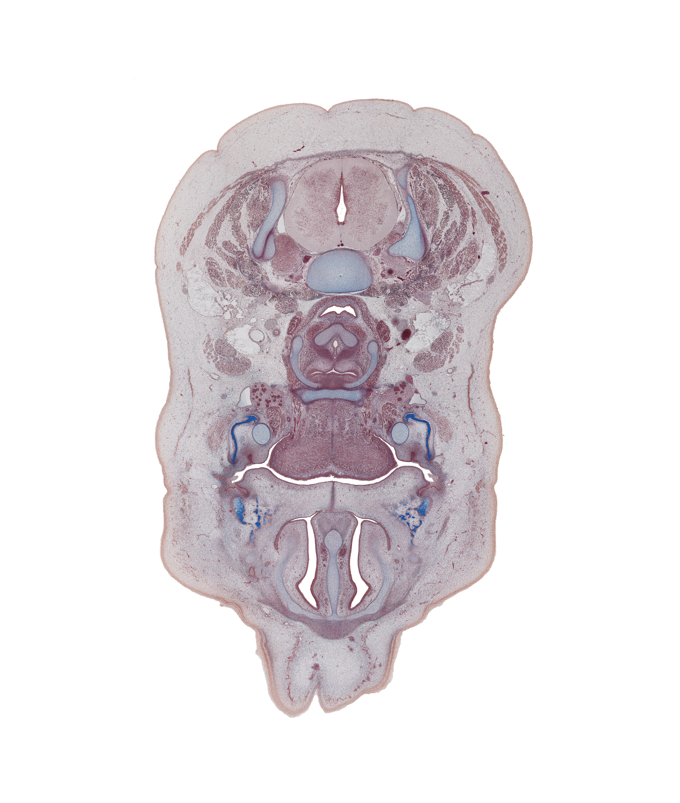 C-5 / C-6 interganglion region, C-5 spinal nerve, body of hyoid (pharyngeal arch 3 cartilage), common carotid artery, fusion region of palatine shelves, inferior nasal concha, internal jugular vein, linguogingival sulcus, mandible ossification, maxilla ossification, nasolacrimal duct, semispinalis cervicis muscle, splenius muscle, sternocleidomastoid muscle, submandibular duct, submandibular gland, superior parathyroid gland, trapezius muscle, vagus nerve (CN X), vomeronasal organ