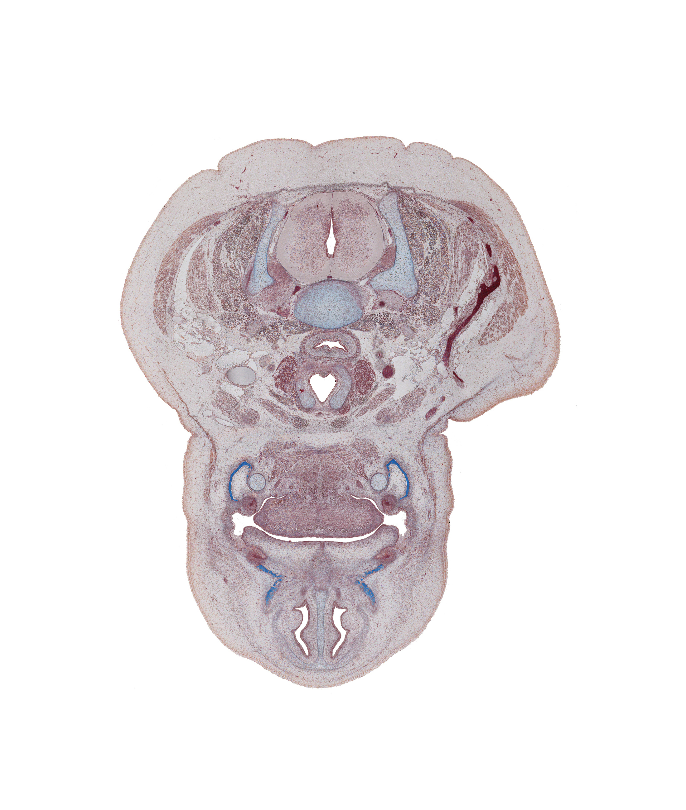 C-6 / C-7 interganglion region, cricoid cartilage, dorsal funiculus, dorsal horn of grey matter, dorsal median septum, external jugular vein, geniohyoid muscle, internal jugular vein, jugular lymph sac, lateral funiculus, nasal cavity (nasal sac), nasal septum, oral cavity, platysma muscle, septal cartilage, sternocleidomastoid muscle, tooth bud(s), ventral funiculus, ventral horn of grey matter, ventral median septum