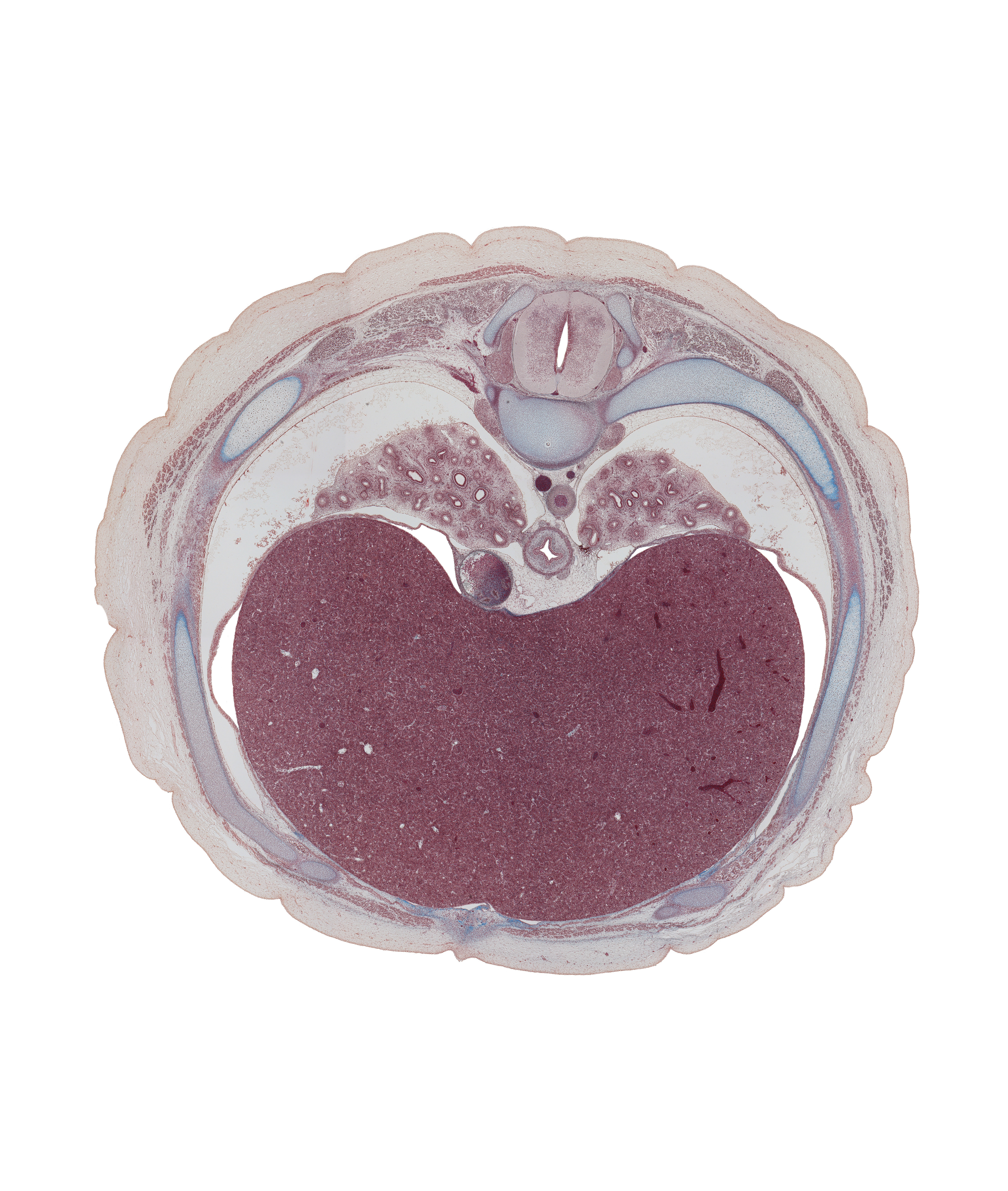 T-7 spinal ganglion, aorta, azygos vein, central canal, central tendon of diaphragm, costal margin, esophagus, inferior hemi-azygos vein, inferior vena cava, latissimus dorsi muscle, left lobe of liver, linea alba, rectus abdominis muscle, rib 8, right lobe of liver, spinal cord, subcostal muscle, trapezius muscle