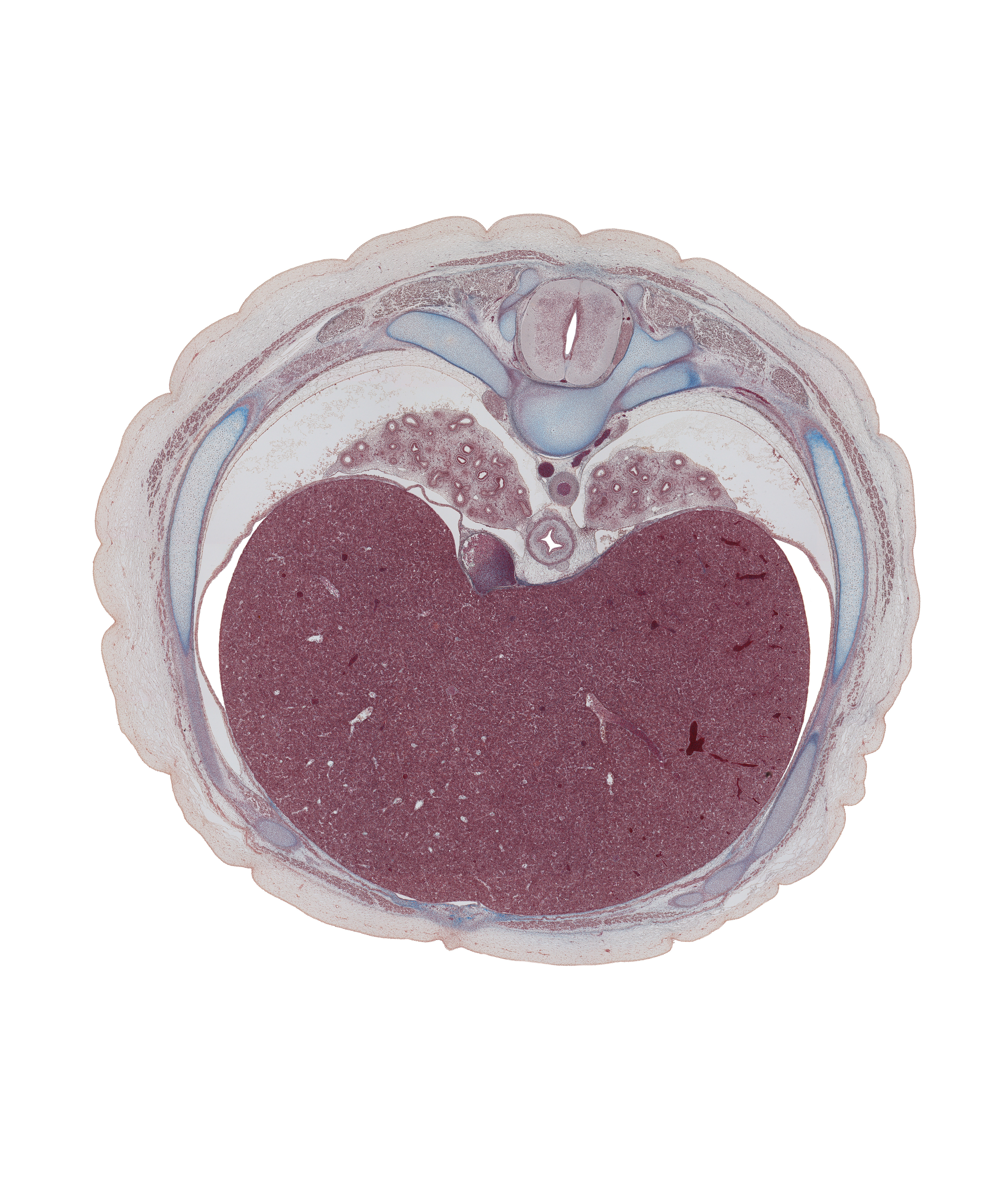 T-8 spinal ganglion, azygos vein, body of rib 8, dorsal funiculus, head of rib 8, inferior vena cava, lateral funiculus, left lobe of liver, lower lobe of left lung, lower lobe of right lung, neural arch, pedicle, pulmonary ligament, rib 8 (costal cartilage), right lobe of liver, sympathetic trunk, transverse process, trapezius muscle, ventral funiculus