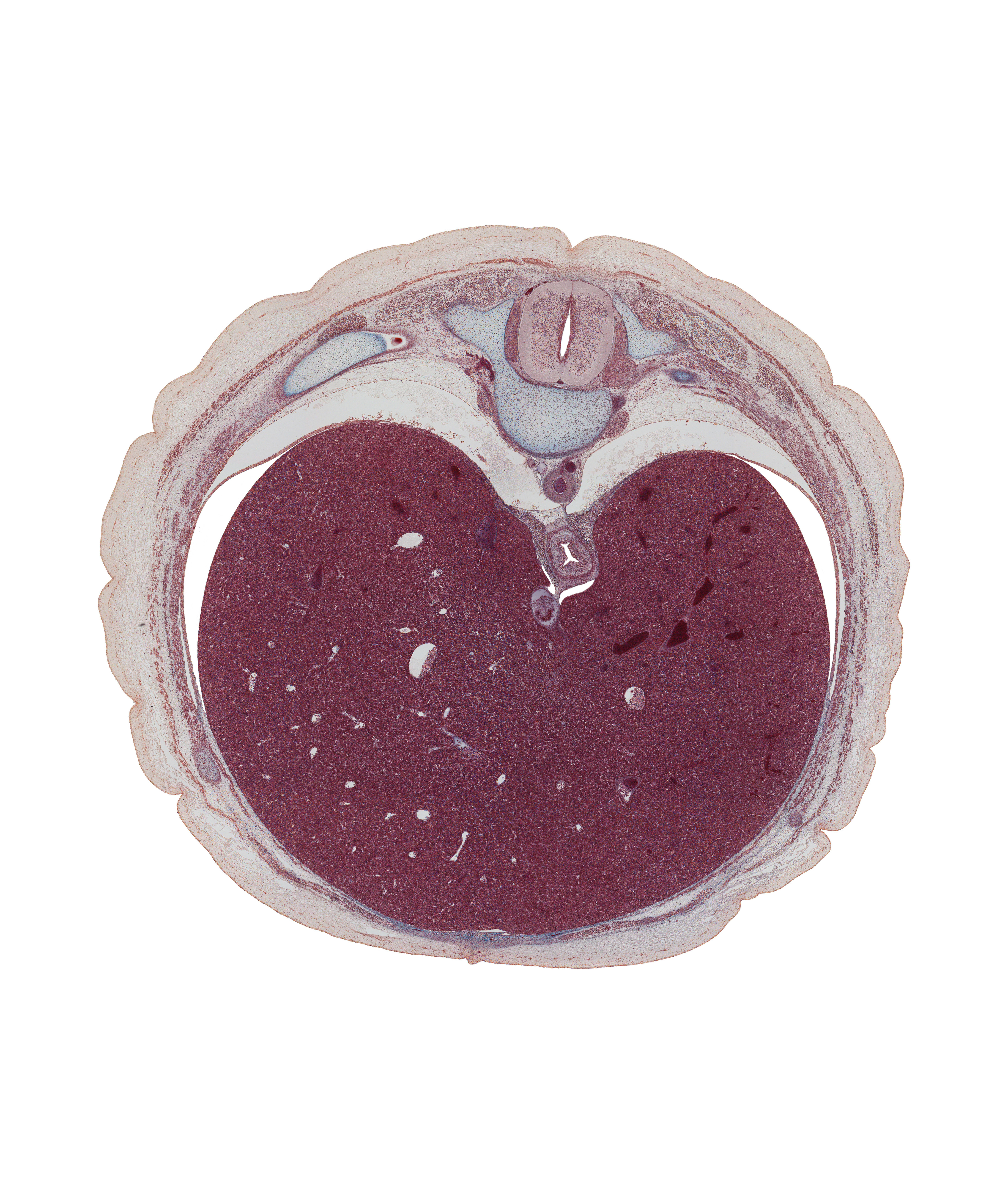 T-9 spinal ganglion, aorta, costal margin, diaphragm, dorsal meso-esophagus, dorsal primary ramus, ductus venosus, efferent hepatic vein, external abdominal oblique muscle, external intercostal muscle(s), inferior vena cava, internal intercostal muscle(s), left lobe of liver, peritoneal cavity, pleural recess, right lobe of liver, ventral meso-esophagus