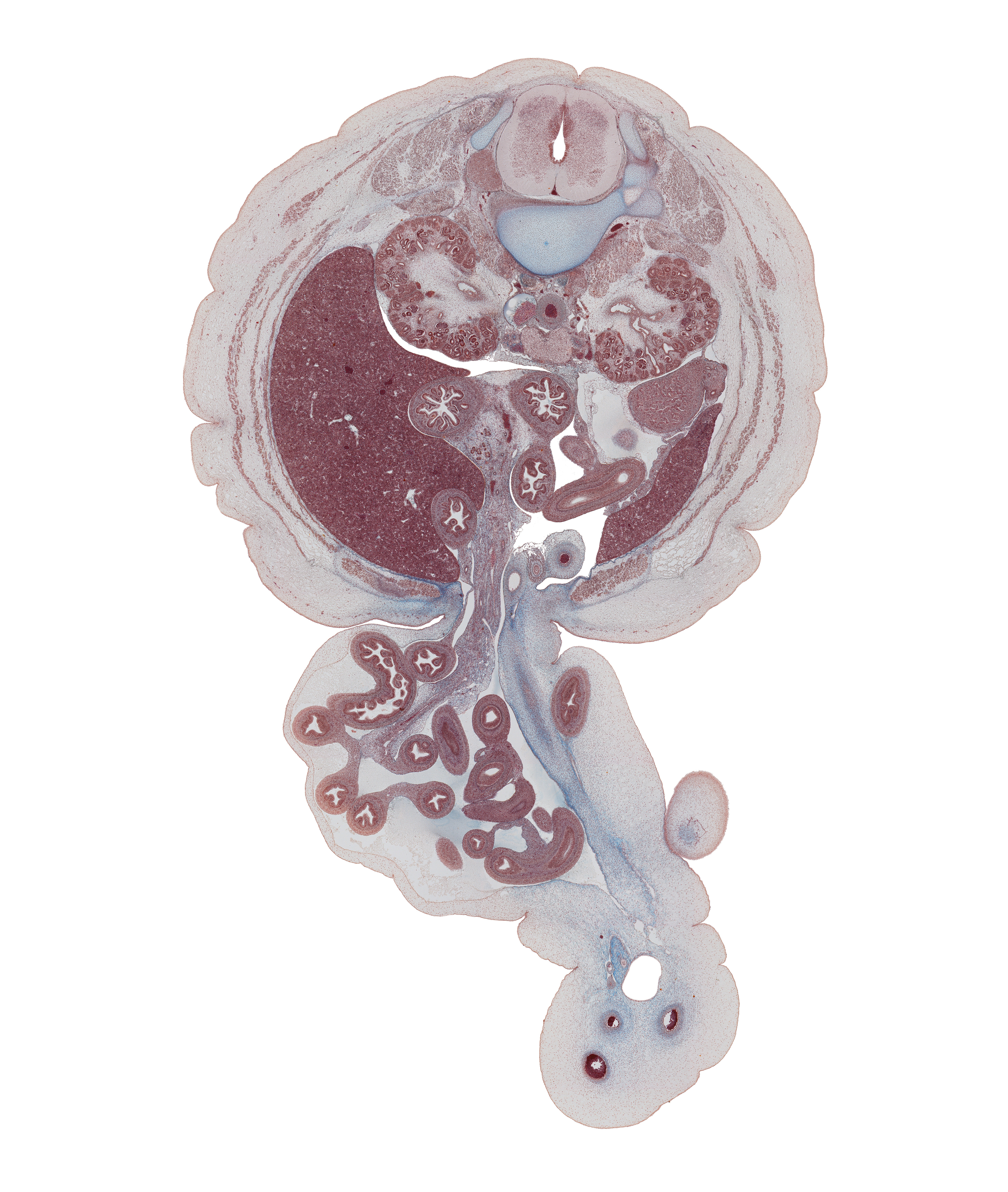 L-1 / L-2 interganglion region, allantoic vesicle(s), aorta, ascending part of duodenum, caudal edge of stomach, cecum, colon, descending part of duodenum, edge of left knee, external abdominal oblique muscle, herniated intestines, inferior vena cava, internal abdominal oblique muscle, jejunum, left lobe of liver, left umbilical artery, mesocolon, middle major calyx, minor calyx, pancreatic duct, renal pelvis, right umbilical artery, testis, transversus abdominis muscle, umbilical cord, umbilical vein, umbilical vesicle stalk