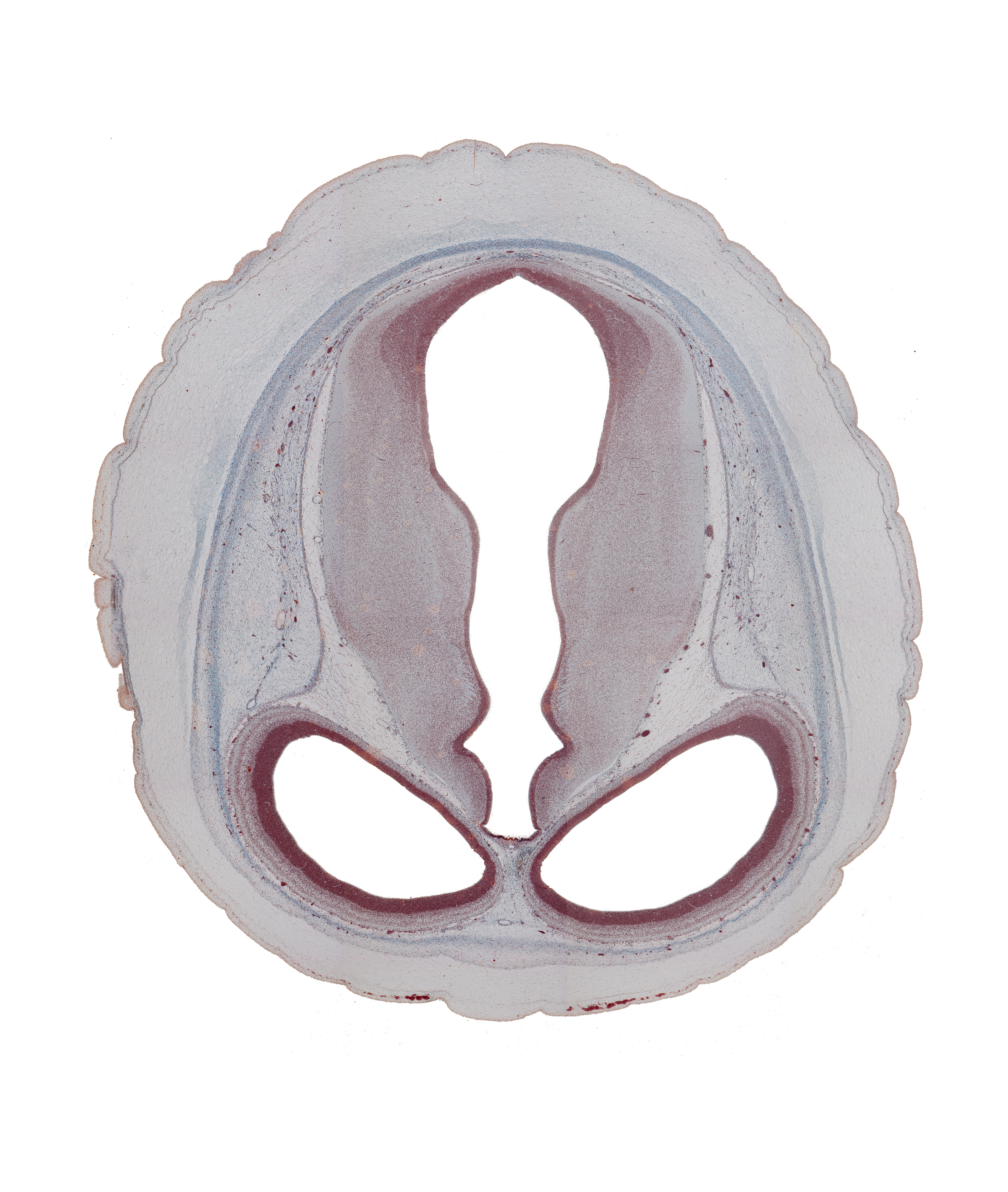 cerebral aqueduct (mesocoele), cerebral hemisphere (neopallium), collicular ridge (tectum), diencephalon, dorsal thalamus (caudal part), dural limiting membrane, ectomeninx, endomeninx, habenular region, hypothalamic sulcus, junction of cerebral aqueduct and third ventricle, lateral ventricle, mesencephalon, osteogenic layer, subarachnoid space, third ventricle