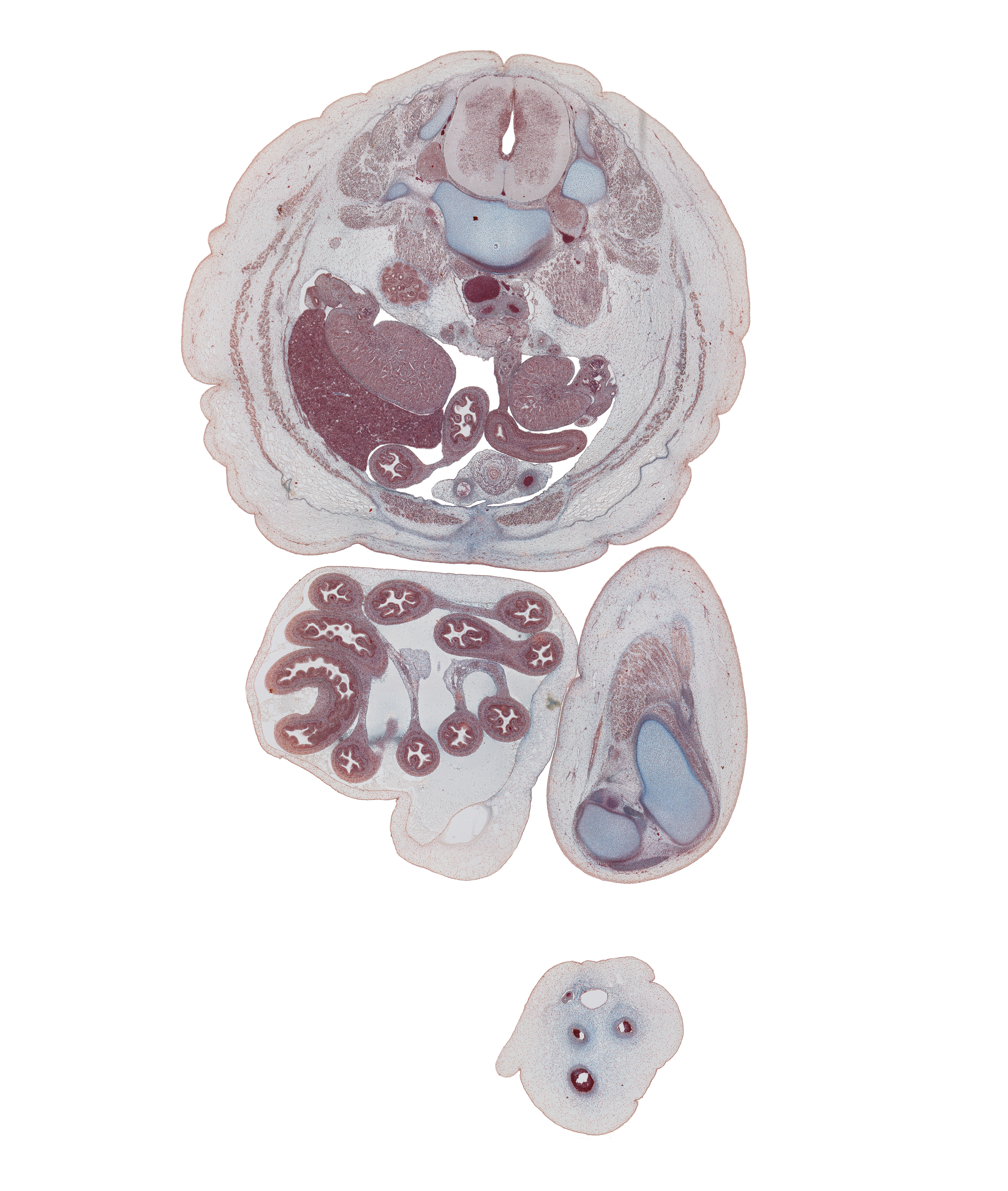 L-3 spinal ganglion, allantoic vein, amnion, colon, edge of sartorius muscle, epididymis, femur, fundus of urinary bladder, inferior pole of kidney (metanephros), inferior vena cava, jejunum, left common iliac artery, left umbilical artery, linea alba, mesentery, mesocolon, mucoid connective tissue, patellar ligament, peritoneal cavity, psoas major muscle, quadriceps femoris muscle, rete testis, right testis, right umbilical artery, superior mesenteric vessels, sympathetic trunk, tibia, umbilical vein, umbilical vesicle stalk, vas deferens