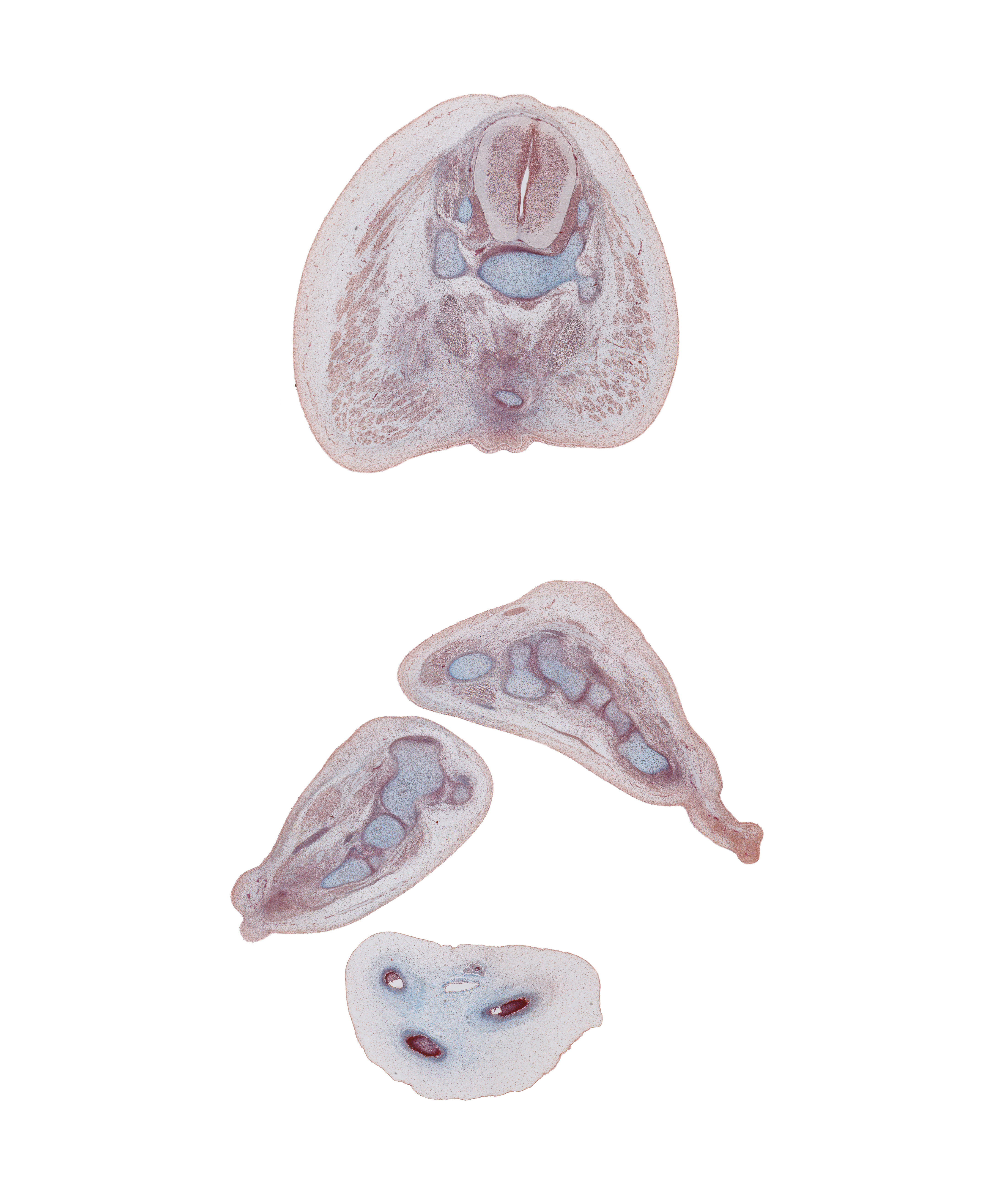 S-3 / S-4 interganglion region, anococcygeal raphe, calcaneum, coccygeus muscle, cuboid, dorsal surface of left foot, fibularis longus and fibularis brevis tendons, flexor digitorum brevis muscle, flexor digitorum longus tendon, gluteus maximus muscle, lower edge of lateral malleolus of fibula, metatarsal 4, plantar aponeurosis, plantar surface of left foot, plantar surface of right foot, quadratus plantae muscle, sympathetic trunk, tip of coccyx