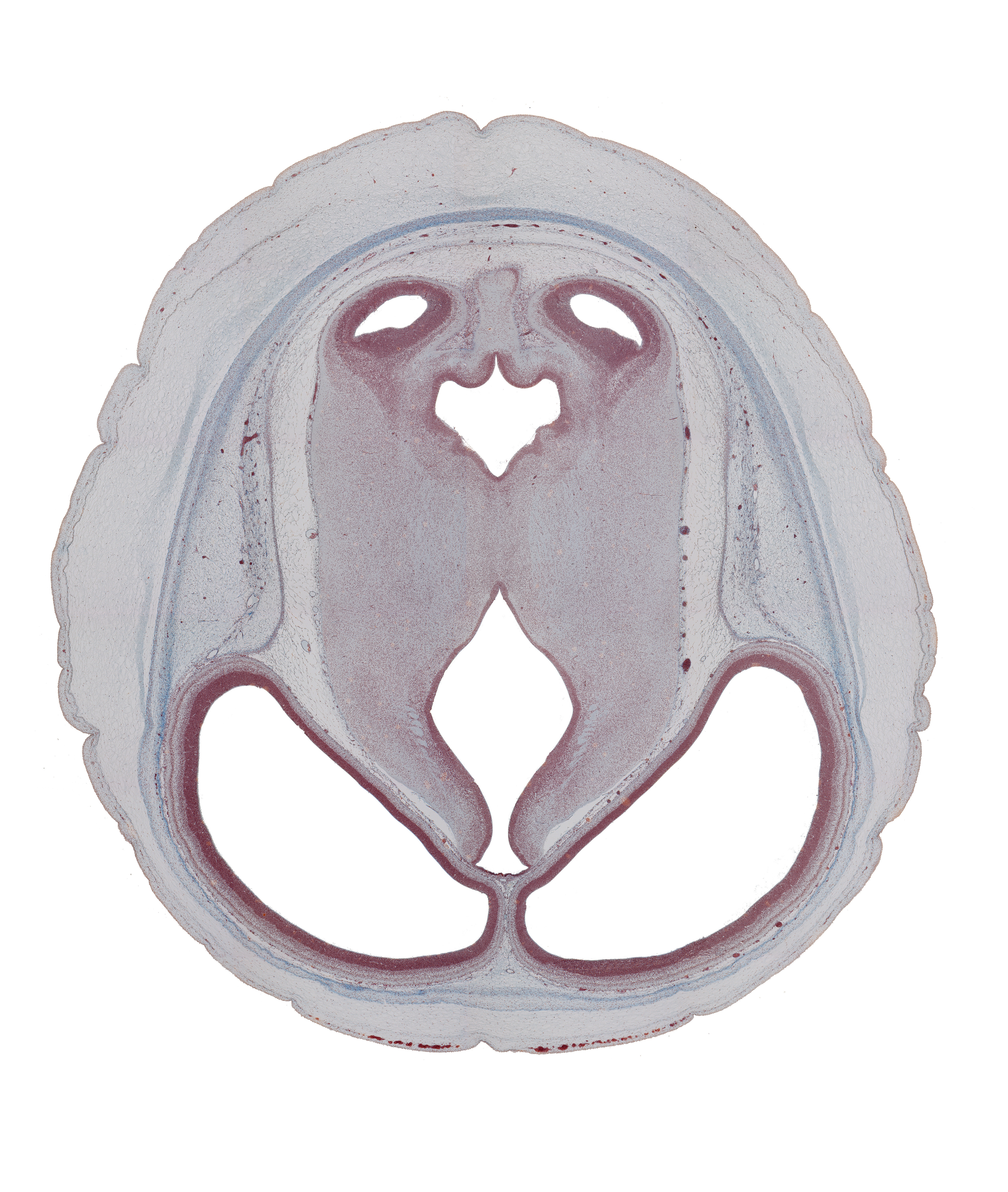 arteries in pia mater, blind sack of cerebral aqueduct, cerebral aqueduct (mesocoele), dorsal thalamus, dural limiting membrane, inferior colliculus, mesencephalon (tegmentum), osteogenic layer, roof of third ventricle, subcutaneous tissue, sulcus dorsalis, sulcus medius, superior medullary vellum region, temporal lobe region of cerebral hemisphere, third ventricle, venous plexus(es)