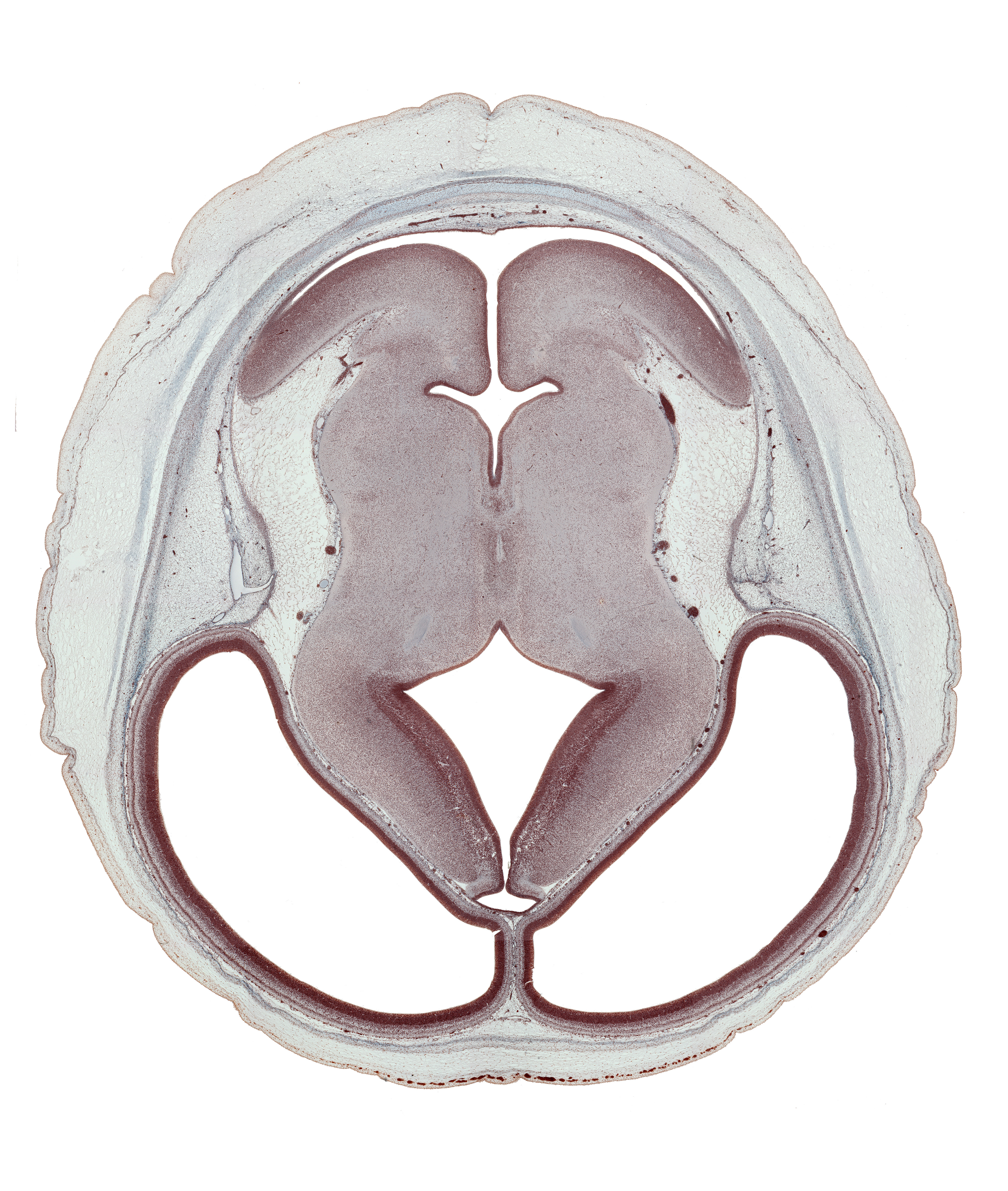 alar plate(s), cerebral hemisphere, dorsal thalamus, dural venous sinus, external germinal area, flocculus of cerebellum, hypothalamic sulcus, isthmus of rhombencephalon, lateral ventricle, median sulcus, membrane area of roof of rhombencoel (fourth ventricle), parietal lobe region, rhombencoel (fourth ventricle), roof of diencephalon, sensory decussation, subarachnoid space, subcutaneous tissue, sulcus dorsalis, third ventricle