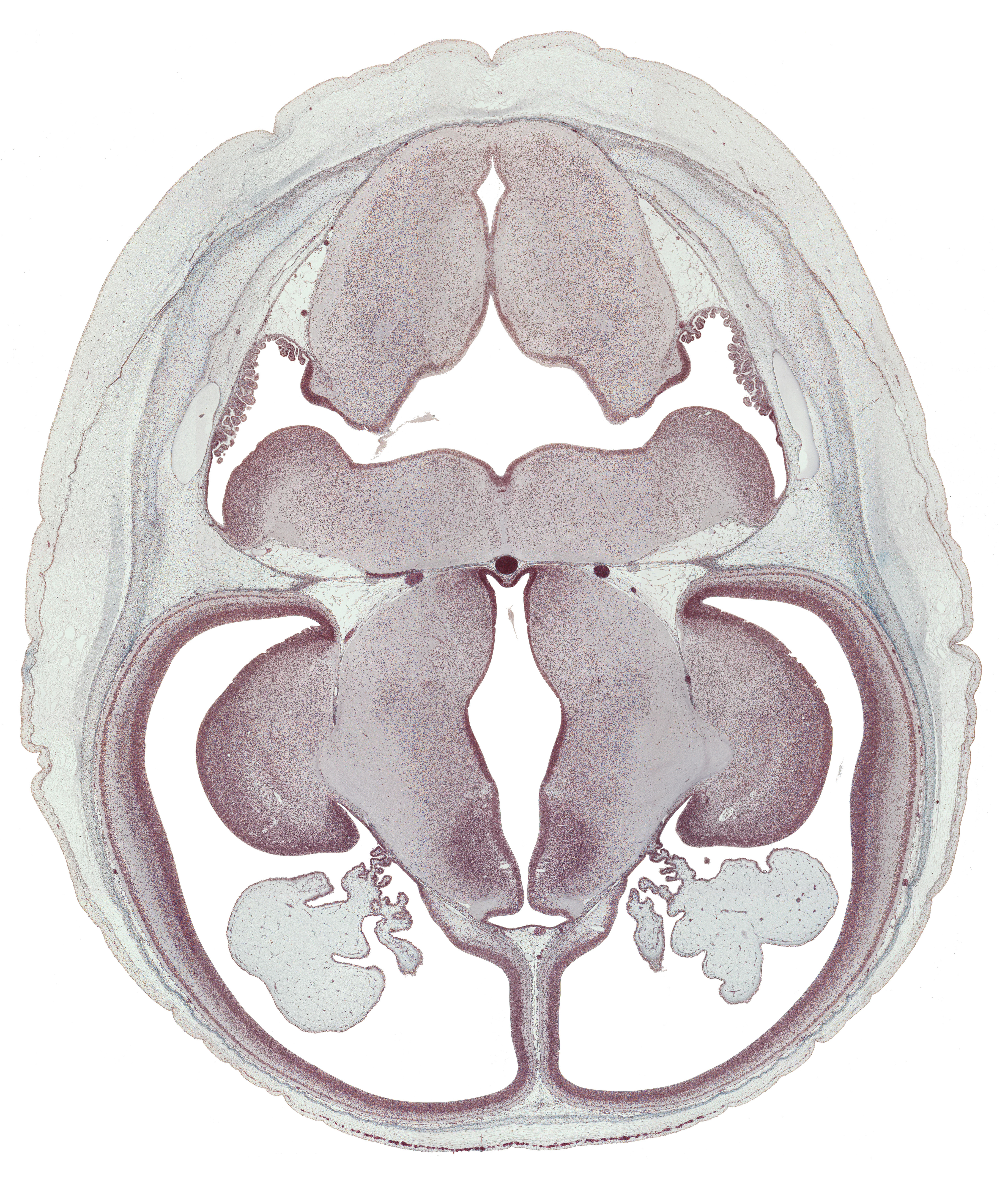 alar plate(s), anterior inferior cerebellar artery, basilar artery, choroid plexus, dorsal thalamus, hypothalamic sulcus, hypothalamus, inferior horn of lateral ventricle, internal capsule, lateral recess of rhombencoel (fourth ventricle), marginal ridge, obex, posterior communicating artery, posterior inferior cerebellar artery, rhombencoel (fourth ventricle), sulcus dorsalis, sulcus medius, third ventricle, ventral thalamus, zona limitans intrathalamica