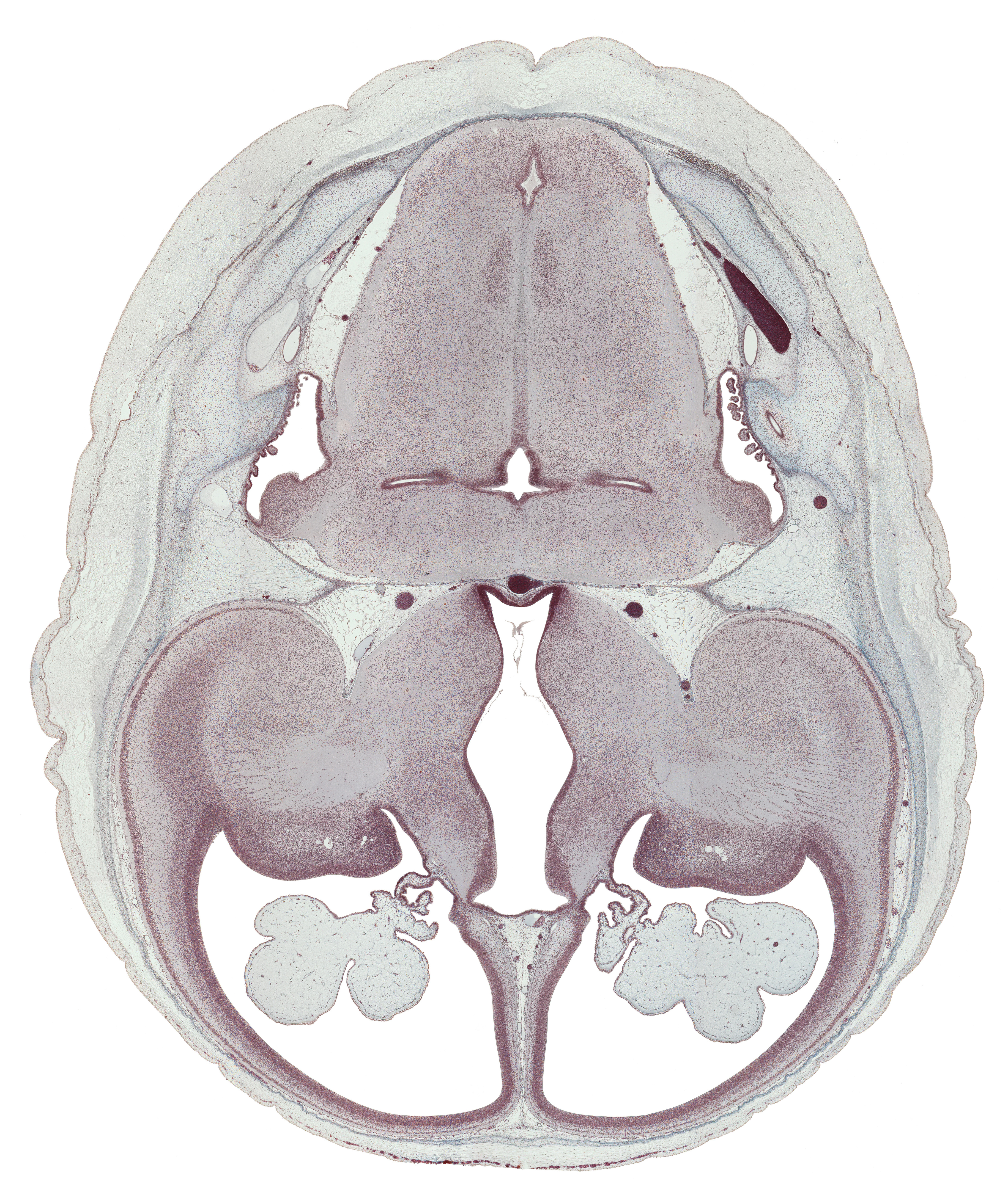 caudate nucleus, choroid fissure, choroid plexus, claustrum, dural band for tentorium cerebelli, endolymphatic sac, globus pallidus, hippocampus, hypothalamic sulcus, hypothalamus, internal capsule, lamina affixa, lateral recess of rhombencoel (fourth ventricle), lateral ventricle, lateral ventricular eminence (telencephalon), medial accessory olivary nucleus, medial ventricular eminence (diencephalon), putamen, rhombencoel (fourth ventricle), spinal tract of trigeminal nerve (CN V), sulcus terminalis, third ventricle, transverse sinus