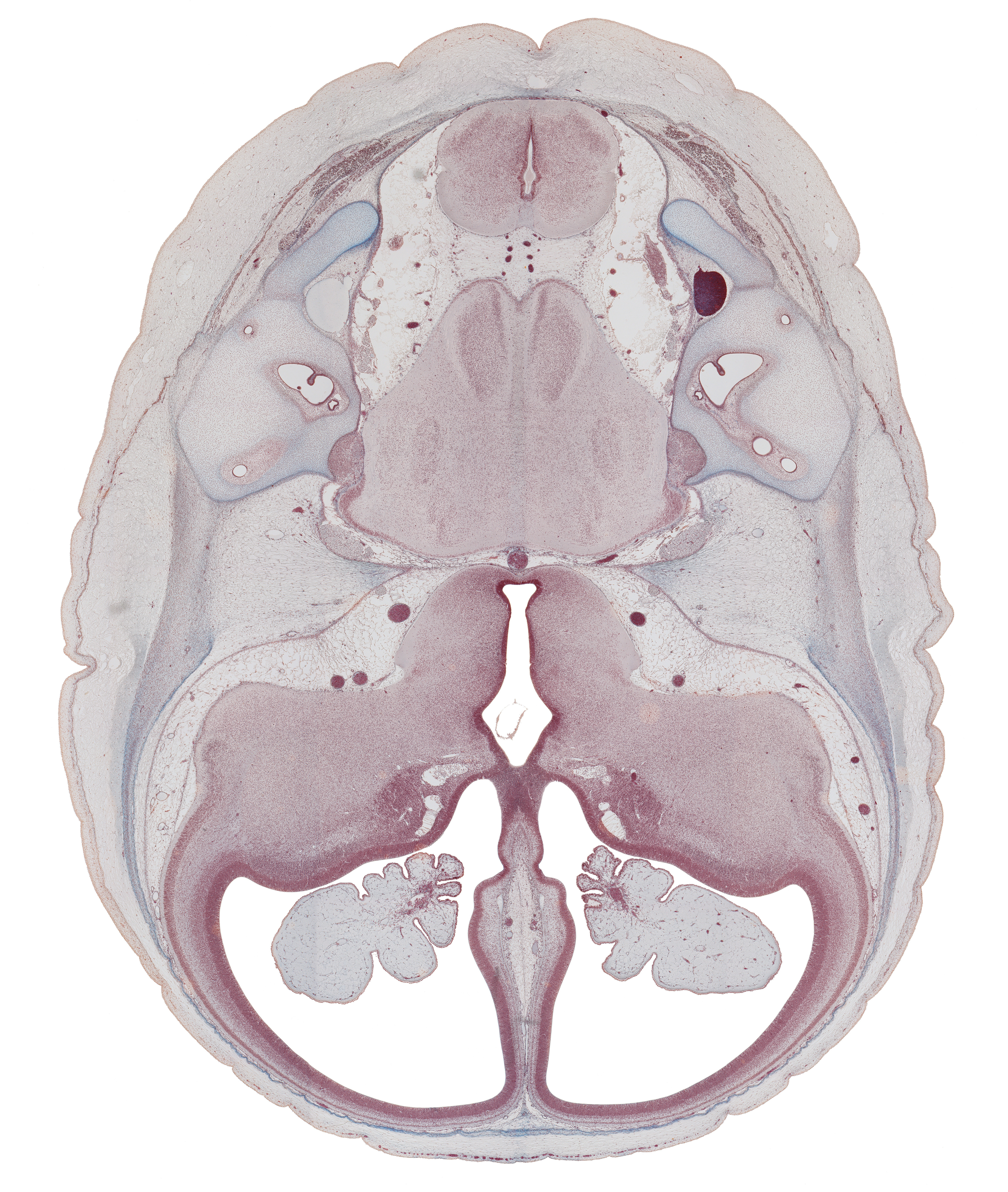 anterior inferior cerebellar artery, anterior semicircular duct, basilar artery, choroid plexus, facial nerve (CN VII), hippocampus, internal acoustic meatus, internal carotid artery, junction of common limb and utricle, lateral ventricle, oculomotor nerve (CN III), optic groove, optic tract, otic capsule, posterior inferior cerebellar artery, region of cervical flexure, root of trigeminal nerve (CN V), semispinalis capitis muscle, superior sagittal sinus, trochlear nerve (CN IV), vestibulocochlear nerve (CN VIII)