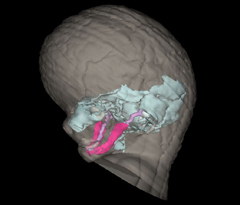 Head & Skull